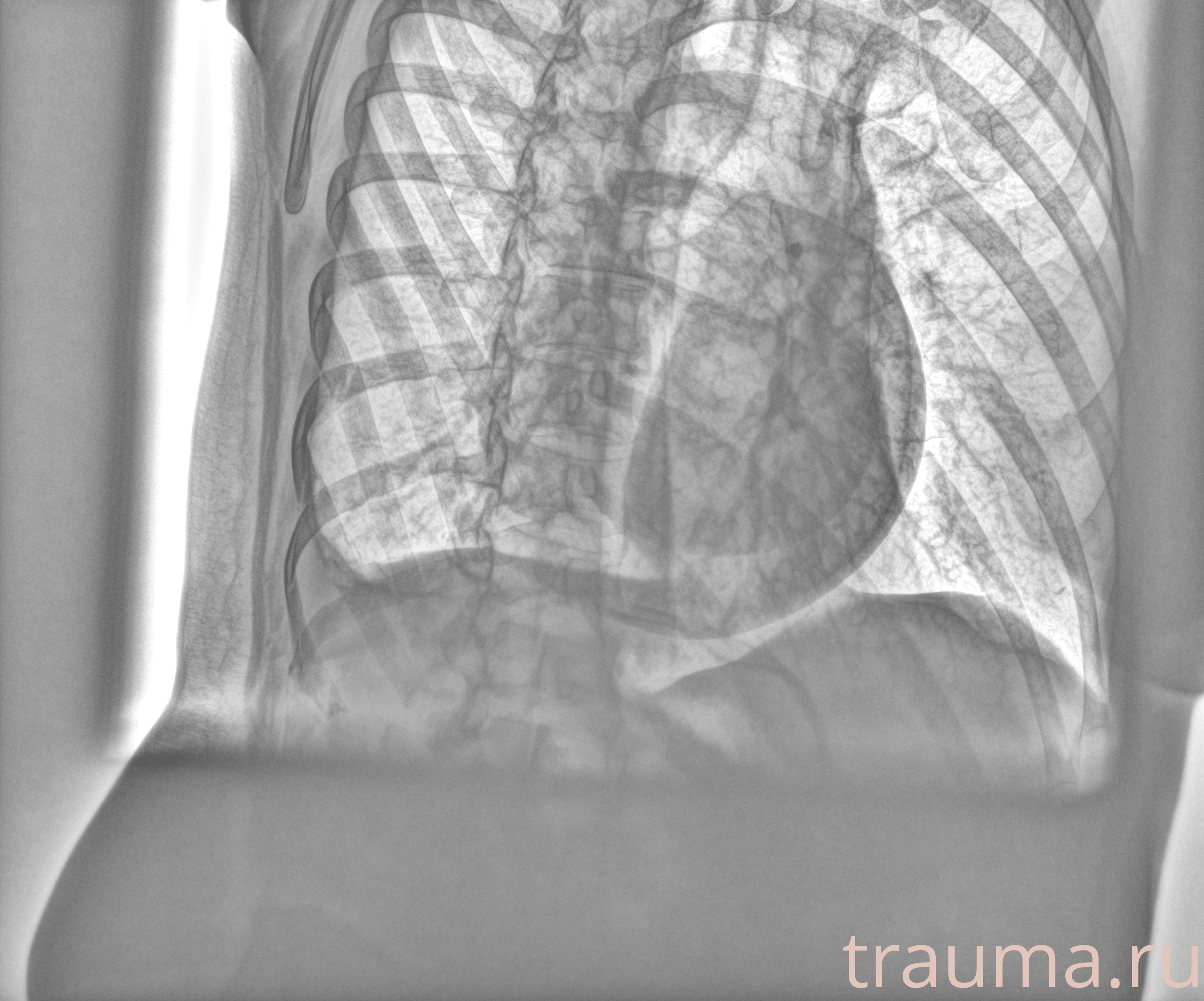 Рентген на дому: по вашему адресу приезжает врач-рентгенолог, травматолог-ортопед с мобильным рентгеновским аппаратом, проводит диагностику травмы или заболевания, делает необходимые рентгенограммы, дает рекомендации по дальнейшему лечению. Получить качественные снимки в домашних условиях возможно благодаря уникальной методике, разработанной МосРентген Центром для института  Склифосовского