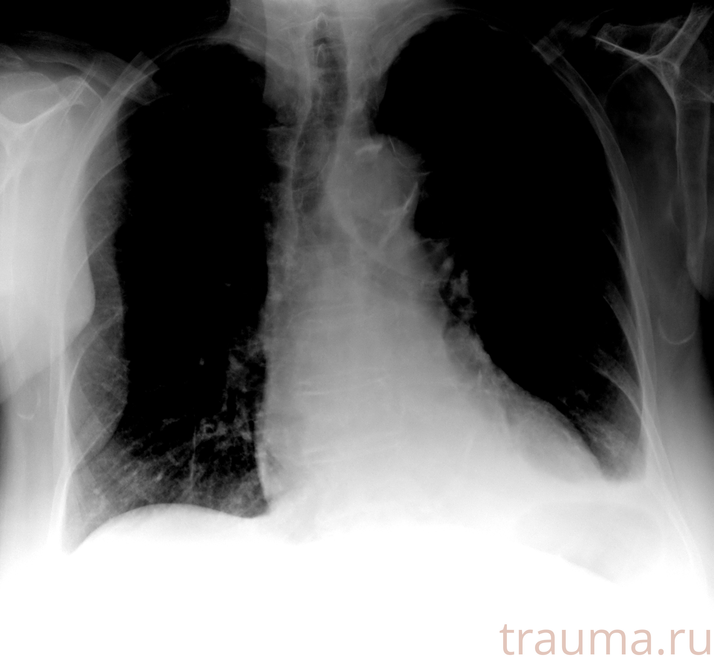 Рентген на дому: по вашему адресу приезжает врач-рентгенолог, травматолог-ортопед с мобильным рентгеновским аппаратом, проводит диагностику травмы или заболевания, делает необходимые рентгенограммы, дает рекомендации по дальнейшему лечению. Получить качественные снимки в домашних условиях возможно благодаря уникальной методике, разработанной МосРентген Центром для института  Склифосовского