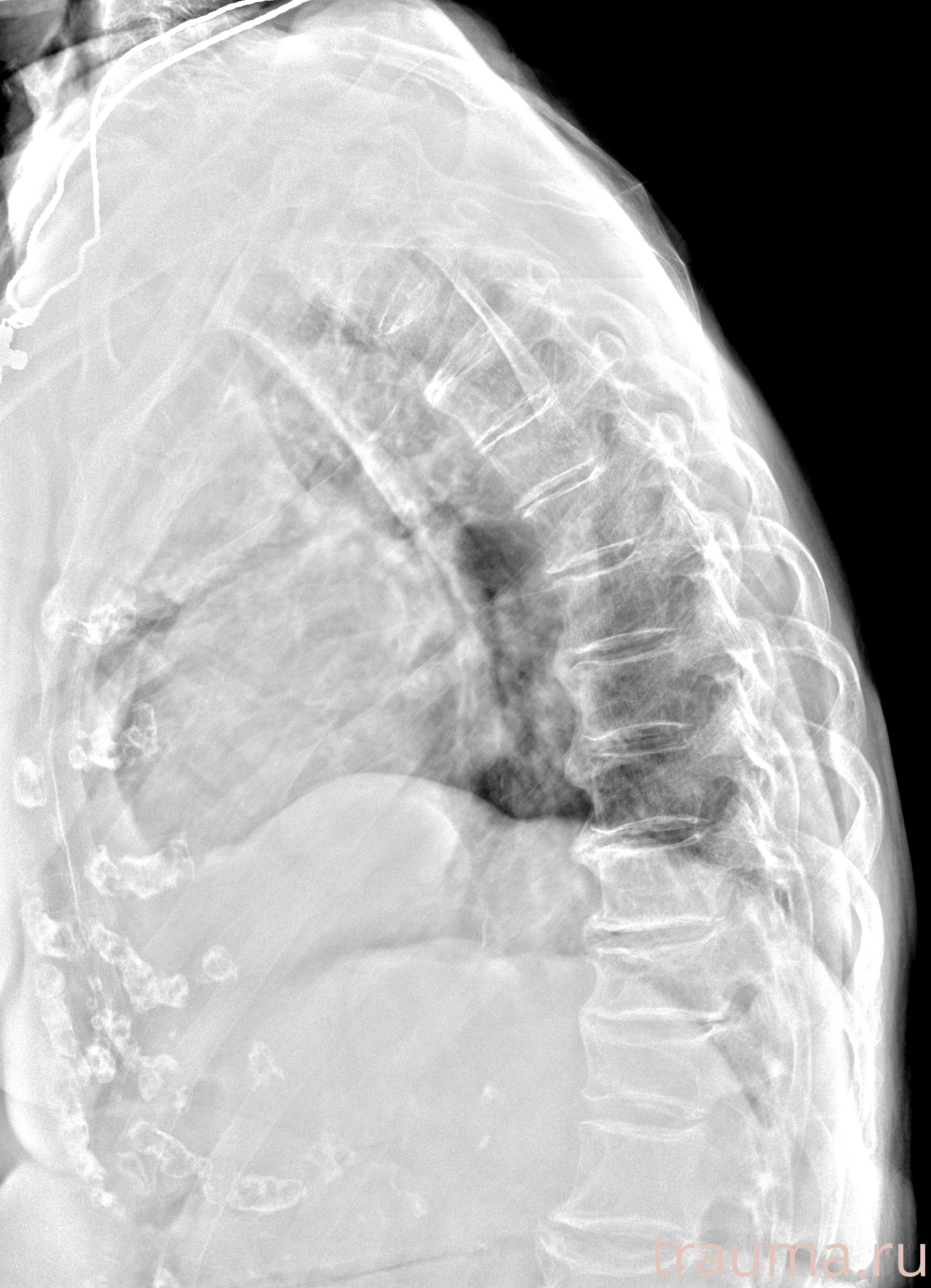 Рентген на дому: по вашему адресу приезжает врач-рентгенолог, травматолог-ортопед с мобильным рентгеновским аппаратом, проводит диагностику травмы или заболевания, делает необходимые рентгенограммы, дает рекомендации по дальнейшему лечению. Получить качественные снимки в домашних условиях возможно благодаря уникальной методике, разработанной МосРентген Центром для института  Склифосовского