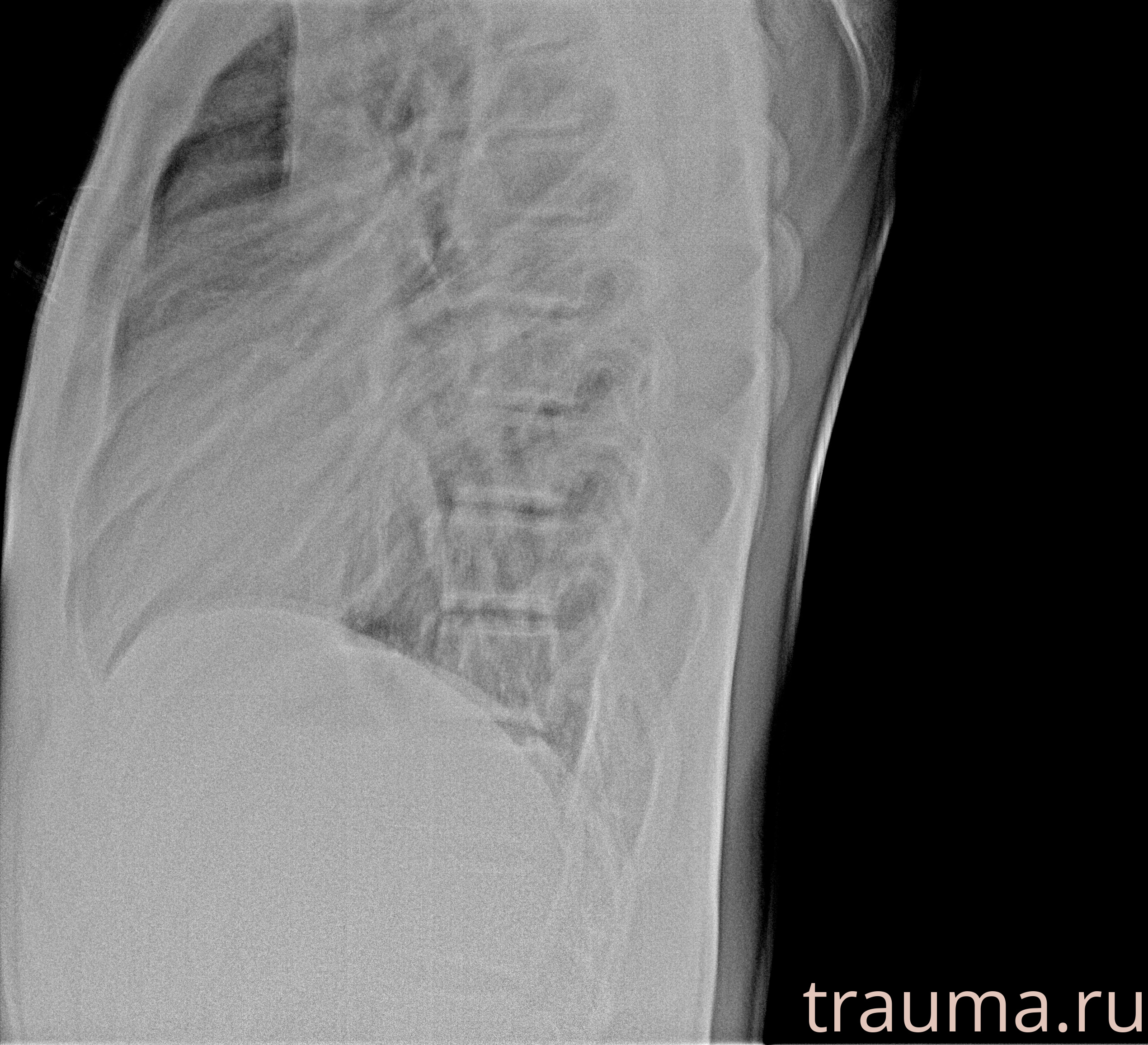 Рентген на дому: по вашему адресу приезжает врач-рентгенолог, травматолог-ортопед с мобильным рентгеновским аппаратом, проводит диагностику травмы или заболевания, делает необходимые рентгенограммы, дает рекомендации по дальнейшему лечению. Получить качественные снимки в домашних условиях возможно благодаря уникальной методике, разработанной МосРентген Центром для института  Склифосовского