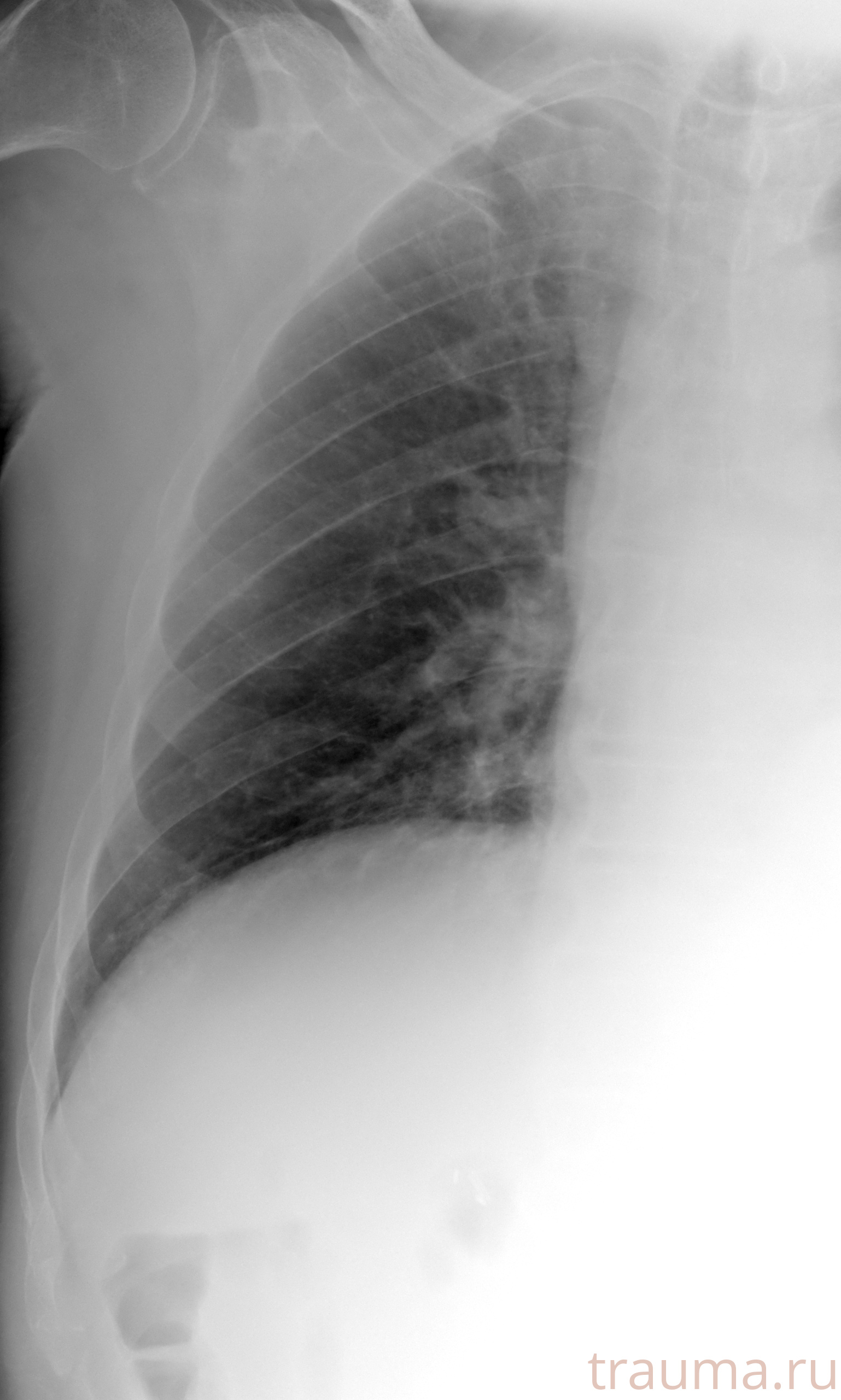 Рентген на дому: по вашему адресу приезжает врач-рентгенолог, травматолог-ортопед с мобильным рентгеновским аппаратом, проводит диагностику травмы или заболевания, делает необходимые рентгенограммы, дает рекомендации по дальнейшему лечению. Получить качественные снимки в домашних условиях возможно благодаря уникальной методике, разработанной МосРентген Центром для института  Склифосовского