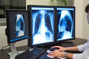 Отображение цифрового рентгеновского снимка  на экране компьютера: проблемы и пути их решения