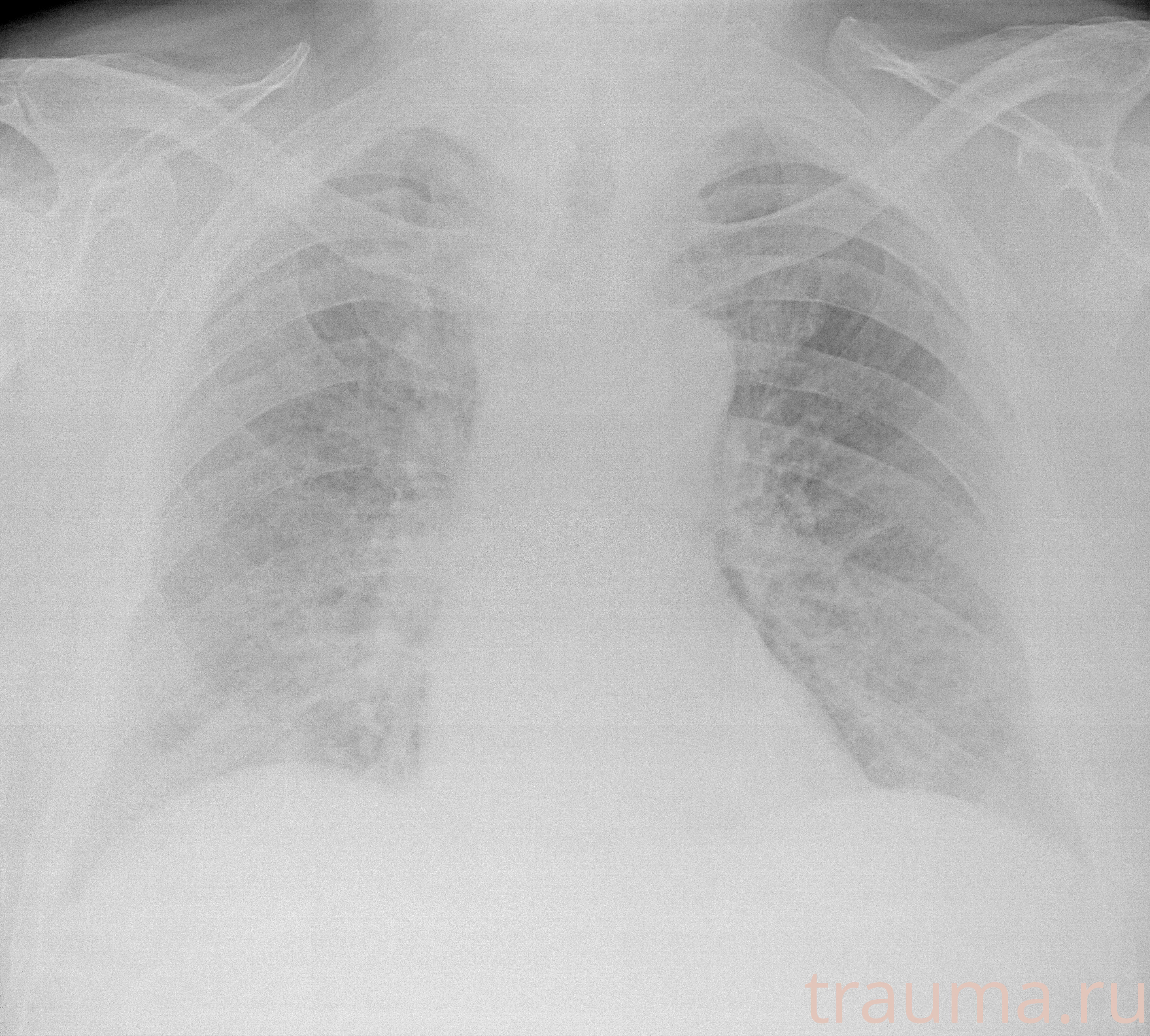 Рентген на дому: по вашему адресу приезжает врач-рентгенолог, травматолог-ортопед с мобильным рентгеновским аппаратом, проводит диагностику травмы или заболевания, делает необходимые рентгенограммы, дает рекомендации по дальнейшему лечению. Получить качественные снимки в домашних условиях возможно благодаря уникальной методике, разработанной МосРентген Центром для института  Склифосовского