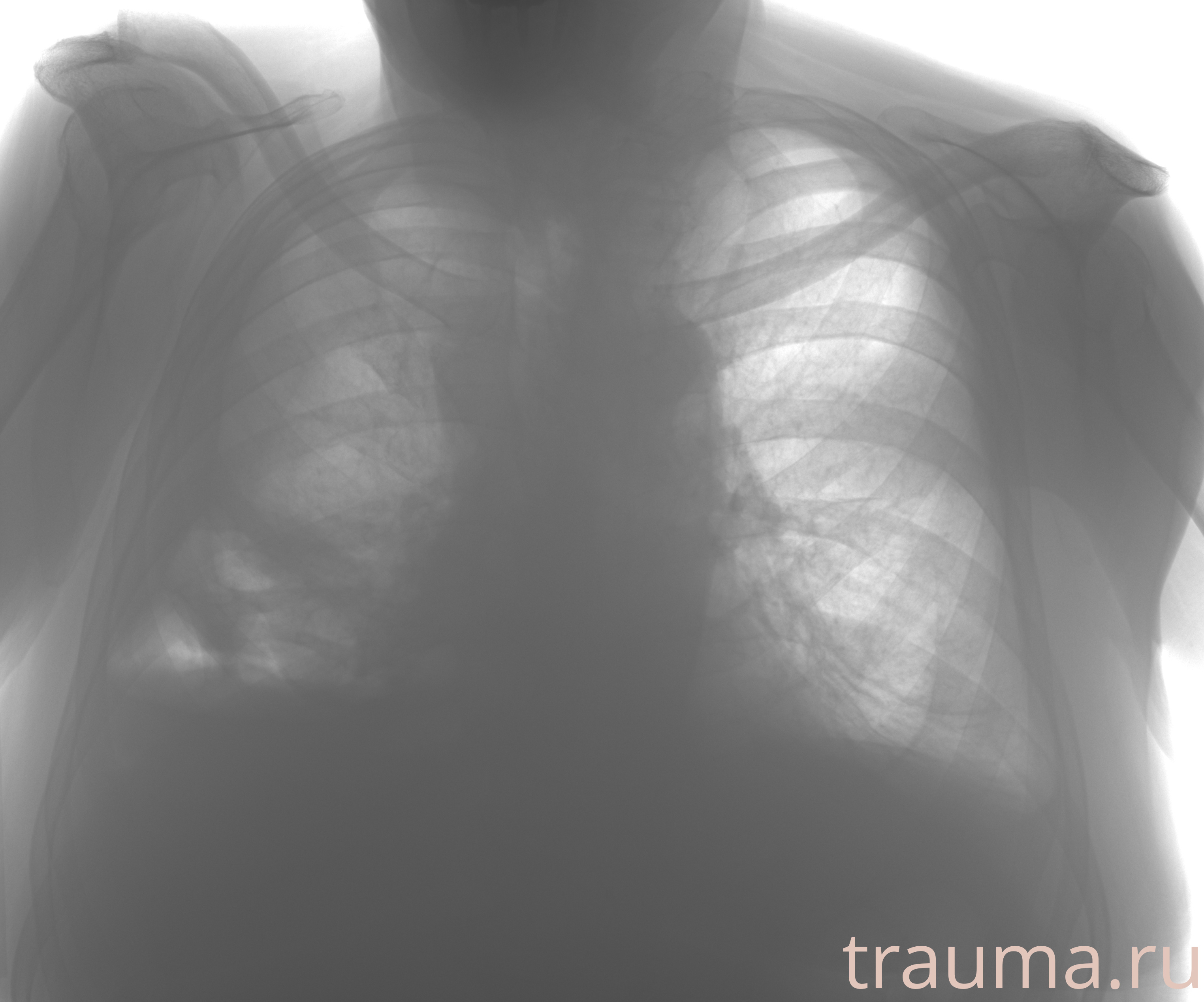 Рентген на дому: по вашему адресу приезжает врач-рентгенолог, травматолог-ортопед с мобильным рентгеновским аппаратом, проводит диагностику травмы или заболевания, делает необходимые рентгенограммы, дает рекомендации по дальнейшему лечению. Получить качественные снимки в домашних условиях возможно благодаря уникальной методике, разработанной МосРентген Центром для института  Склифосовского