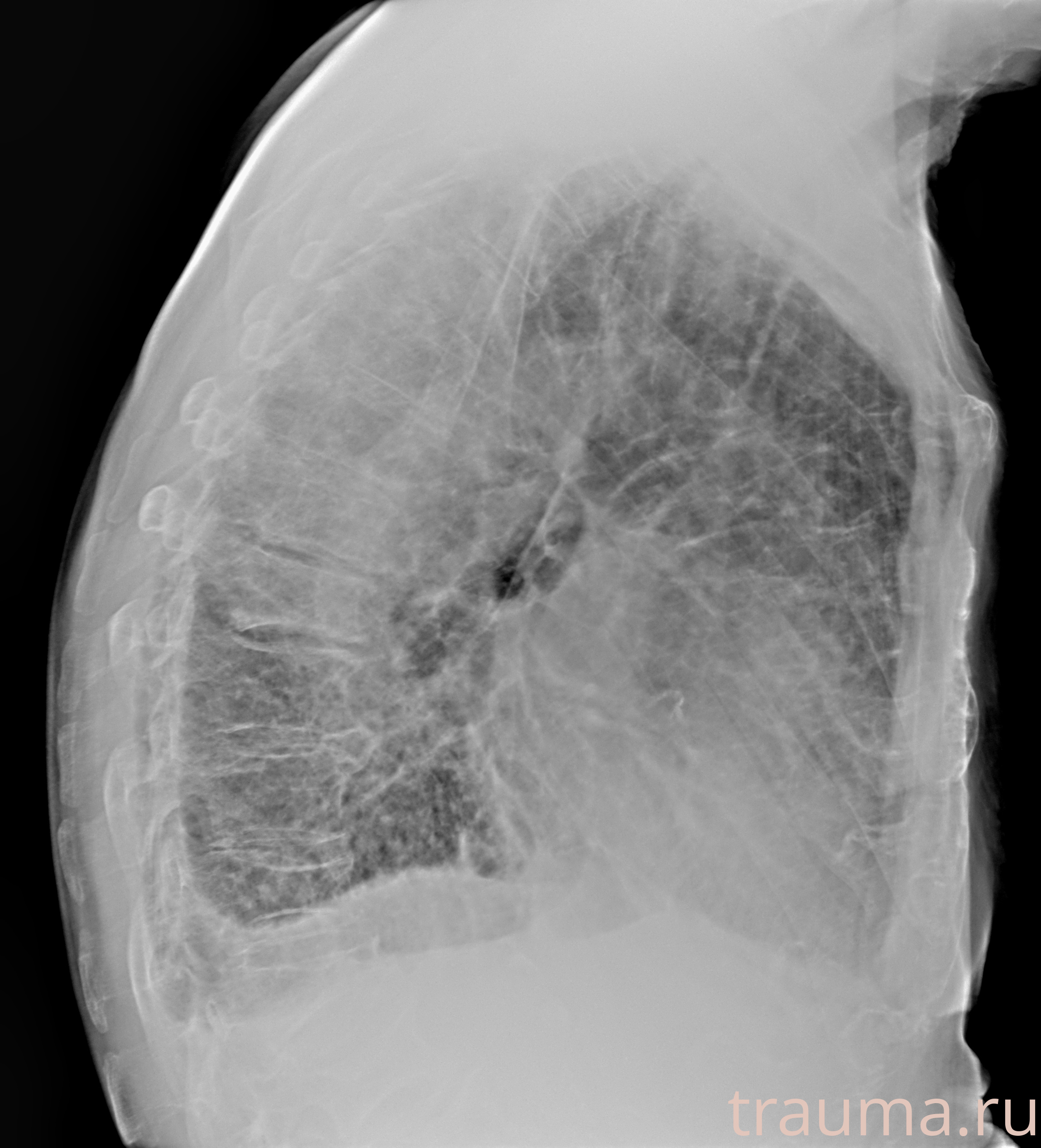 Рентген на дому: по вашему адресу приезжает врач-рентгенолог, травматолог-ортопед с мобильным рентгеновским аппаратом, проводит диагностику травмы или заболевания, делает необходимые рентгенограммы, дает рекомендации по дальнейшему лечению. Получить качественные снимки в домашних условиях возможно благодаря уникальной методике, разработанной МосРентген Центром для института  Склифосовского