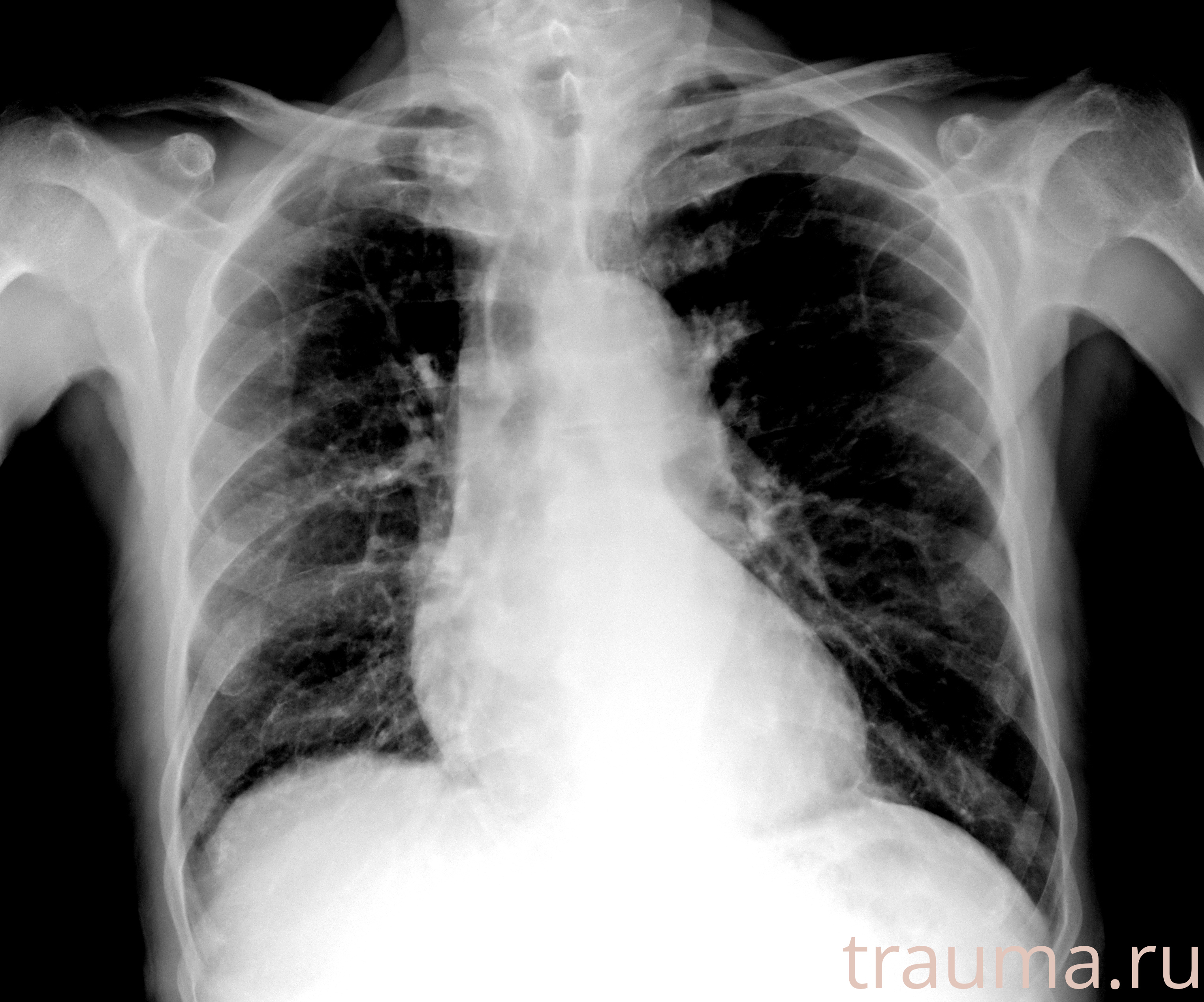 Рентген на дому: по вашему адресу приезжает врач-рентгенолог, травматолог-ортопед с мобильным рентгеновским аппаратом, проводит диагностику травмы или заболевания, делает необходимые рентгенограммы, дает рекомендации по дальнейшему лечению. Получить качественные снимки в домашних условиях возможно благодаря уникальной методике, разработанной МосРентген Центром для института  Склифосовского