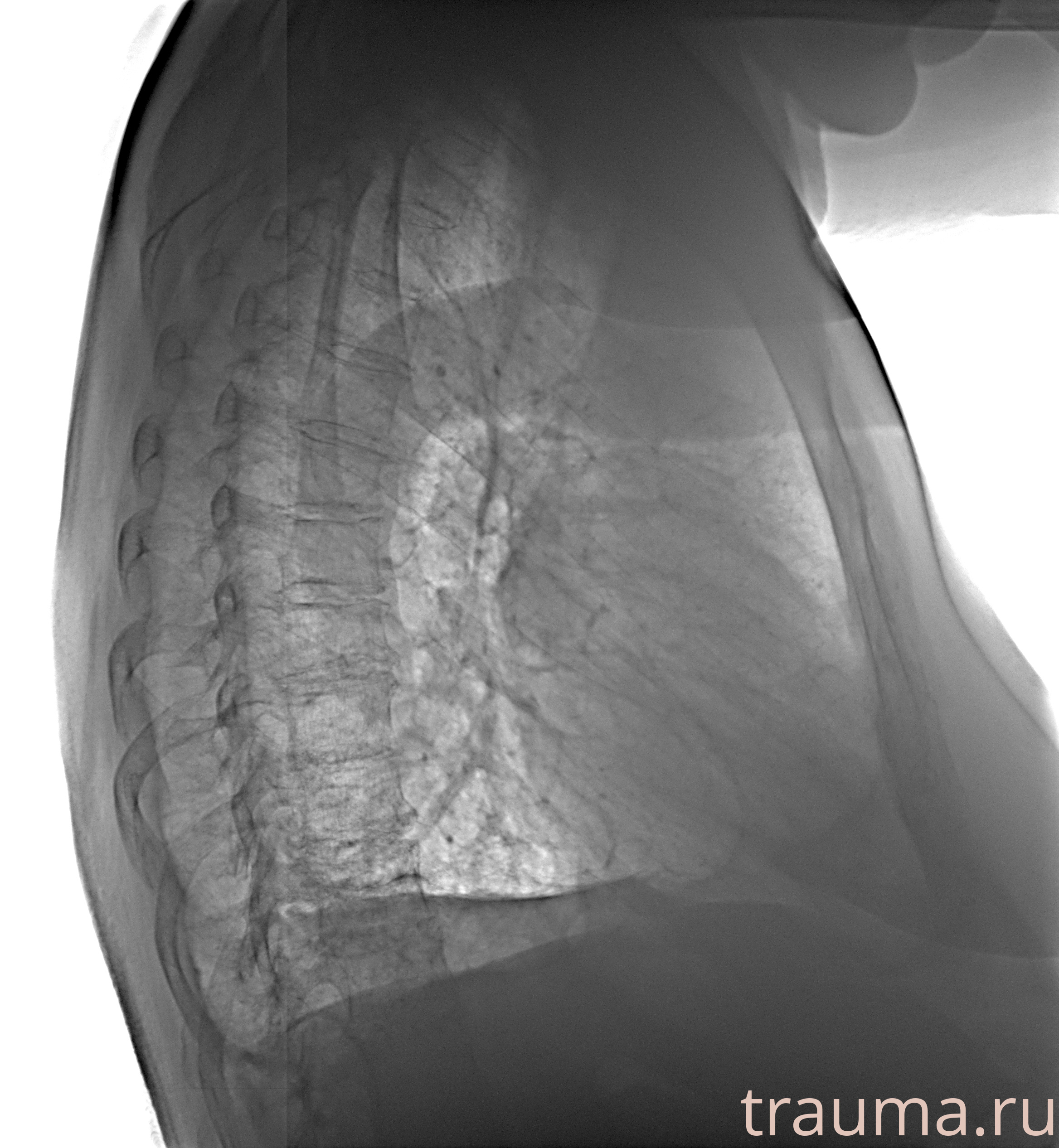 Рентген на дому: по вашему адресу приезжает врач-рентгенолог, травматолог-ортопед с мобильным рентгеновским аппаратом, проводит диагностику травмы или заболевания, делает необходимые рентгенограммы, дает рекомендации по дальнейшему лечению. Получить качественные снимки в домашних условиях возможно благодаря уникальной методике, разработанной МосРентген Центром для института  Склифосовского