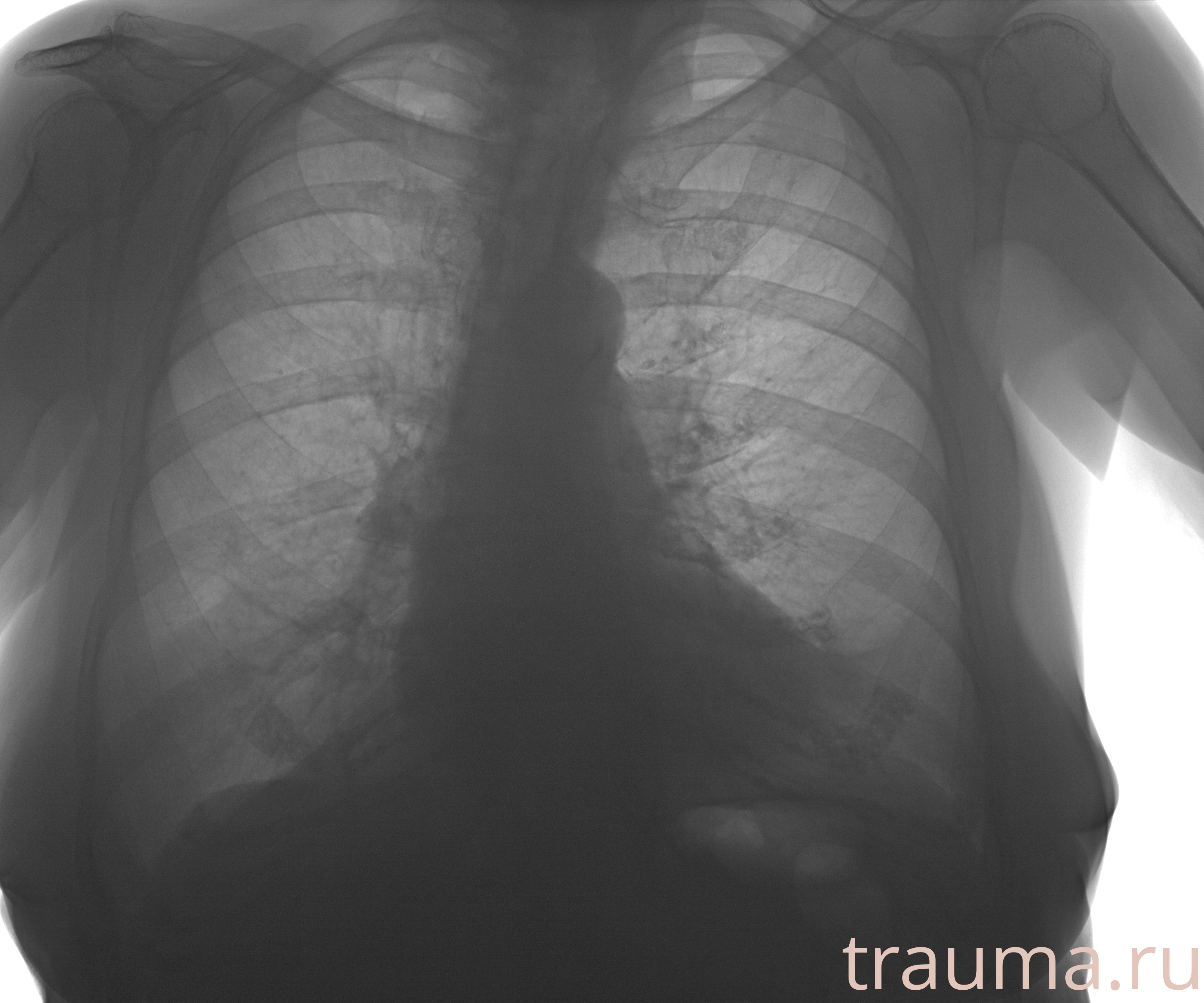Рентген на дому: по вашему адресу приезжает врач-рентгенолог, травматолог-ортопед с мобильным рентгеновским аппаратом, проводит диагностику травмы или заболевания, делает необходимые рентгенограммы, дает рекомендации по дальнейшему лечению. Получить качественные снимки в домашних условиях возможно благодаря уникальной методике, разработанной МосРентген Центром для института  Склифосовского