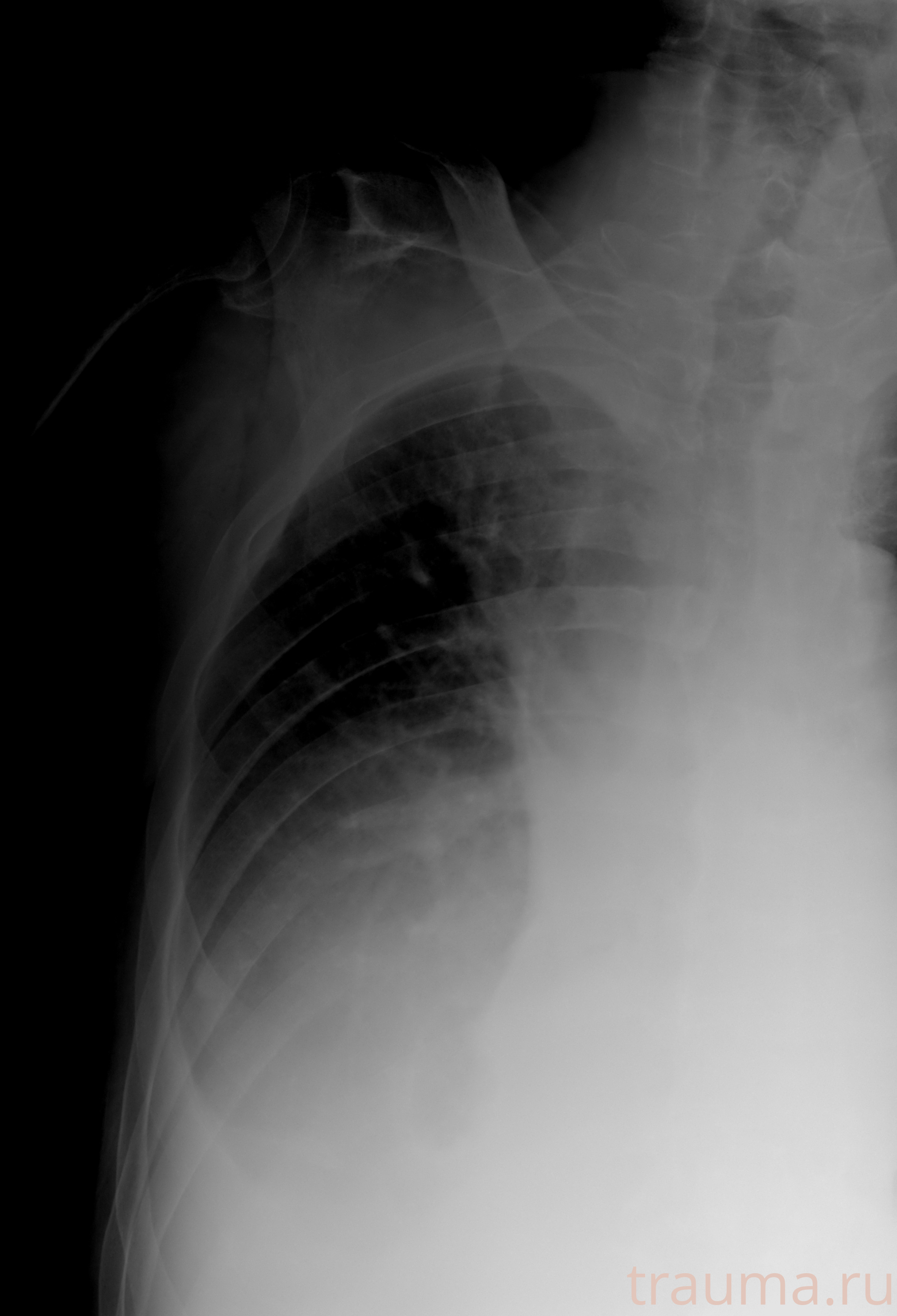 Рентген на дому: по вашему адресу приезжает врач-рентгенолог, травматолог-ортопед с мобильным рентгеновским аппаратом, проводит диагностику травмы или заболевания, делает необходимые рентгенограммы, дает рекомендации по дальнейшему лечению. Получить качественные снимки в домашних условиях возможно благодаря уникальной методике, разработанной МосРентген Центром для института  Склифосовского