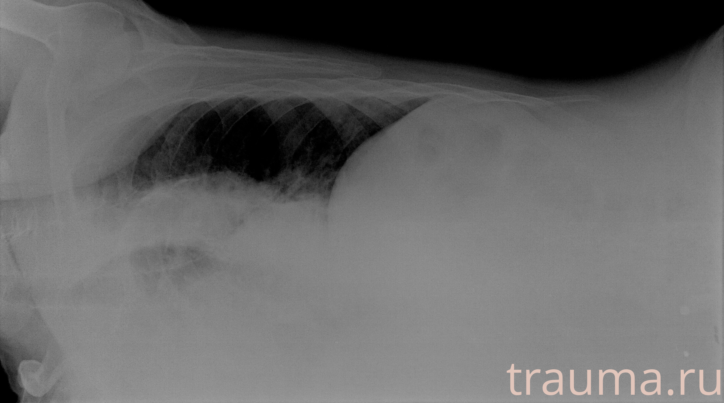 Рентген на дому: по вашему адресу приезжает врач-рентгенолог, травматолог-ортопед с мобильным рентгеновским аппаратом, проводит диагностику травмы или заболевания, делает необходимые рентгенограммы, дает рекомендации по дальнейшему лечению. Получить качественные снимки в домашних условиях возможно благодаря уникальной методике, разработанной МосРентген Центром для института  Склифосовского