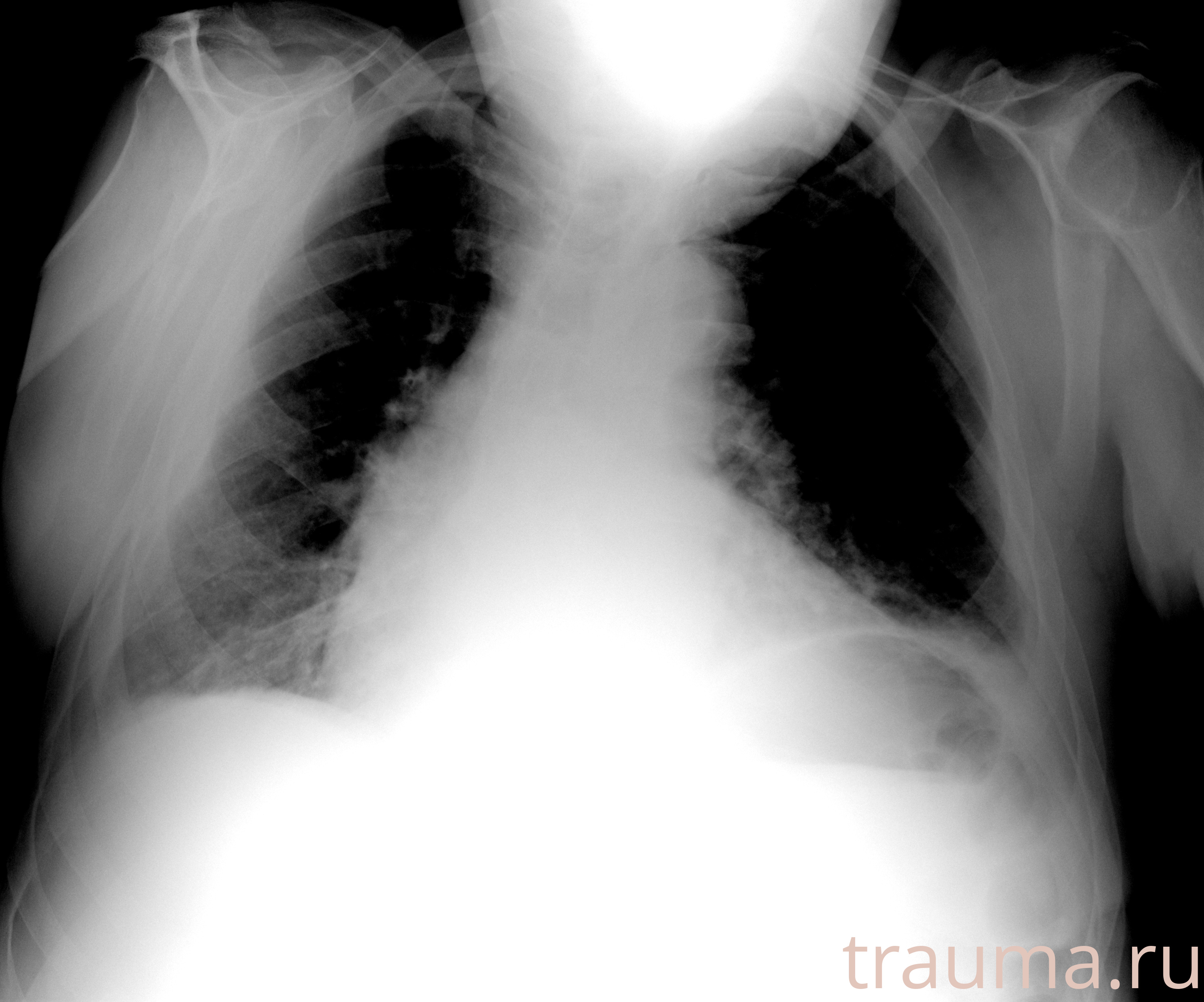 Рентген на дому: по вашему адресу приезжает врач-рентгенолог, травматолог-ортопед с мобильным рентгеновским аппаратом, проводит диагностику травмы или заболевания, делает необходимые рентгенограммы, дает рекомендации по дальнейшему лечению. Получить качественные снимки в домашних условиях возможно благодаря уникальной методике, разработанной МосРентген Центром для института  Склифосовского