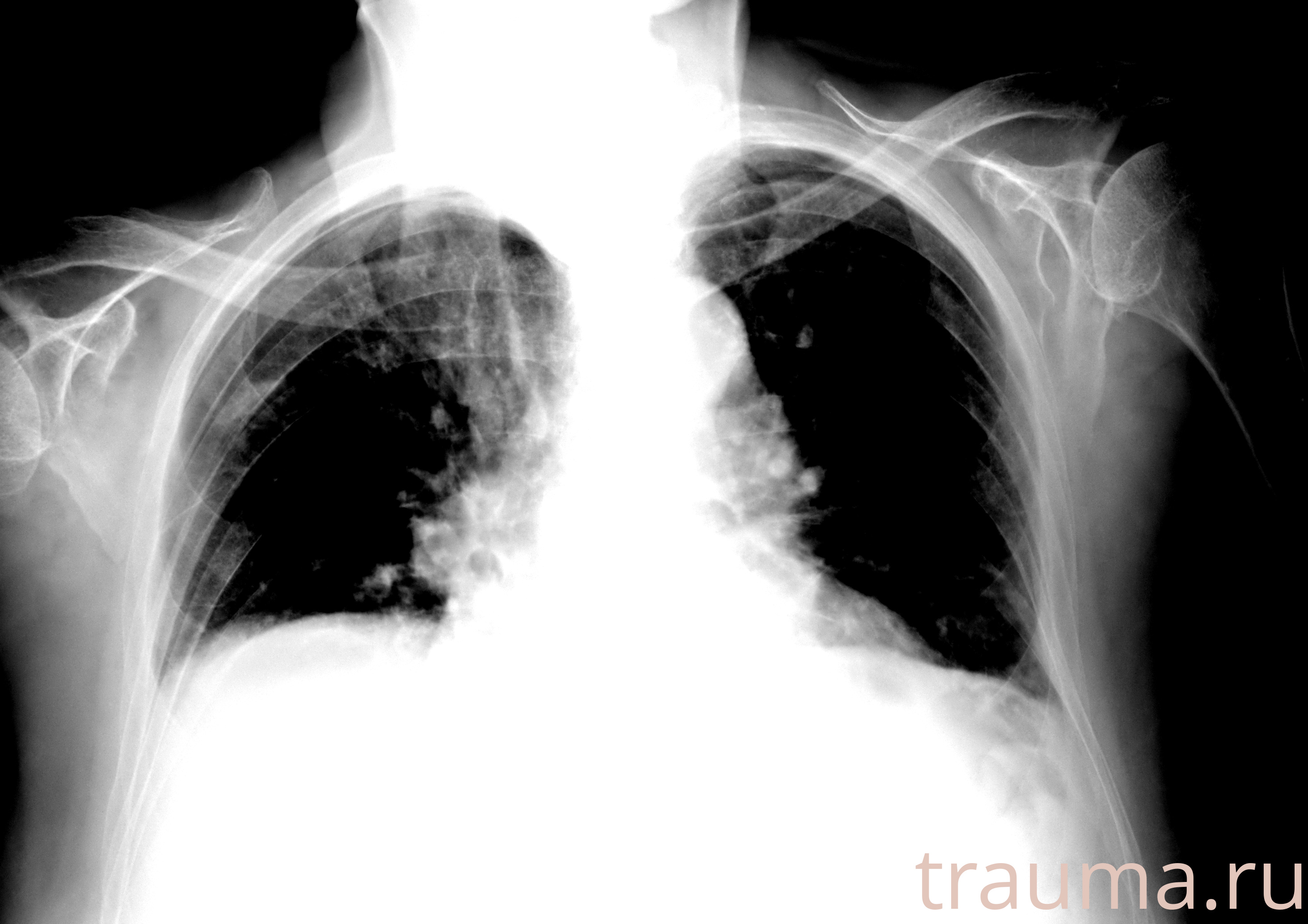 Рентген на дому: по вашему адресу приезжает врач-рентгенолог, травматолог-ортопед с мобильным рентгеновским аппаратом, проводит диагностику травмы или заболевания, делает необходимые рентгенограммы, дает рекомендации по дальнейшему лечению. Получить качественные снимки в домашних условиях возможно благодаря уникальной методике, разработанной МосРентген Центром для института  Склифосовского