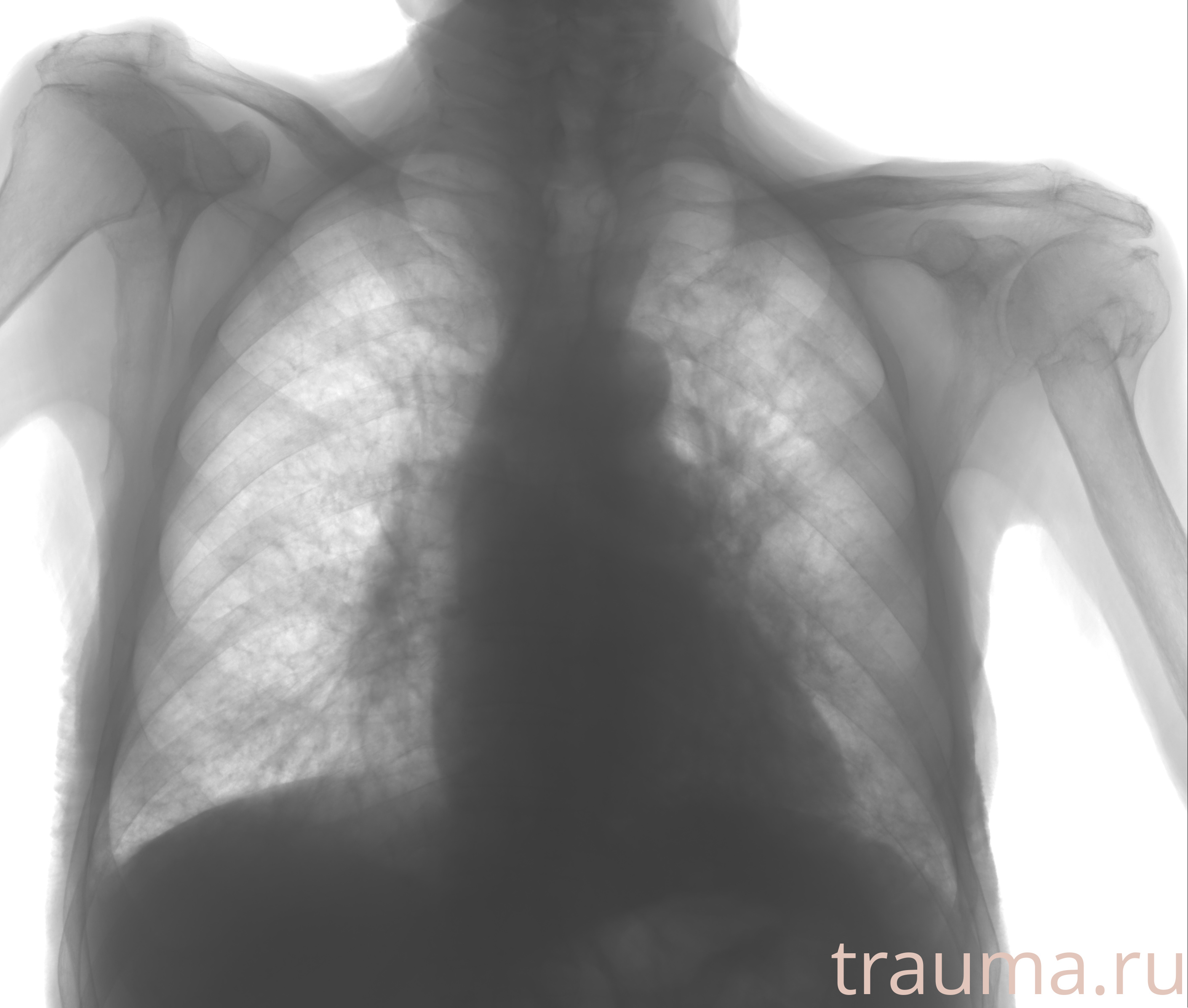 Рентген на дому: по вашему адресу приезжает врач-рентгенолог, травматолог-ортопед с мобильным рентгеновским аппаратом, проводит диагностику травмы или заболевания, делает необходимые рентгенограммы, дает рекомендации по дальнейшему лечению. Получить качественные снимки в домашних условиях возможно благодаря уникальной методике, разработанной МосРентген Центром для института  Склифосовского