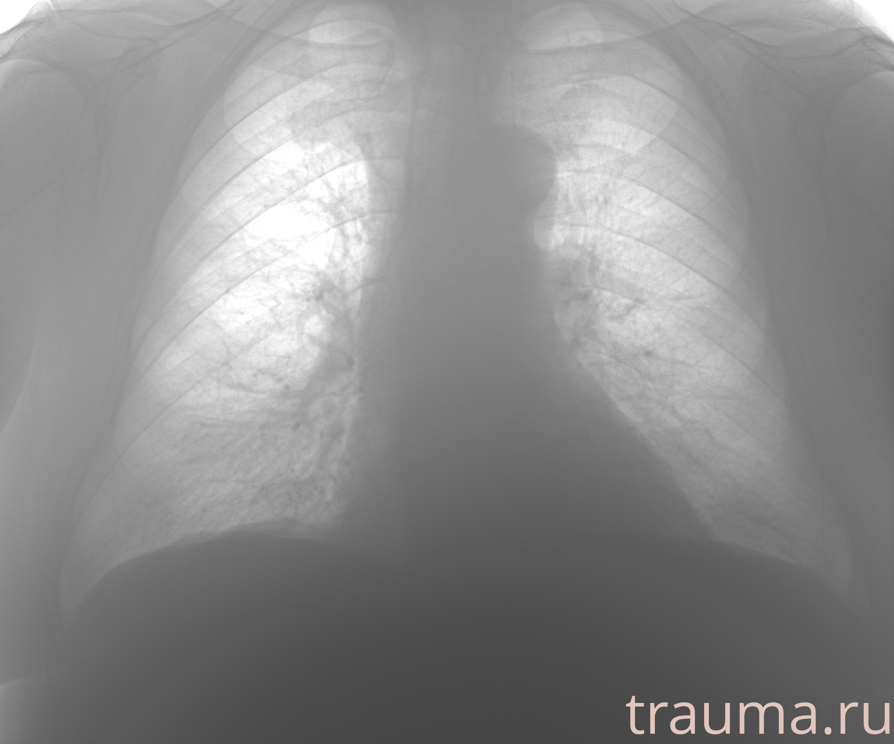 Рентген на дому: по вашему адресу приезжает врач-рентгенолог, травматолог-ортопед с мобильным рентгеновским аппаратом, проводит диагностику травмы или заболевания, делает необходимые рентгенограммы, дает рекомендации по дальнейшему лечению. Получить качественные снимки в домашних условиях возможно благодаря уникальной методике, разработанной МосРентген Центром для института  Склифосовского