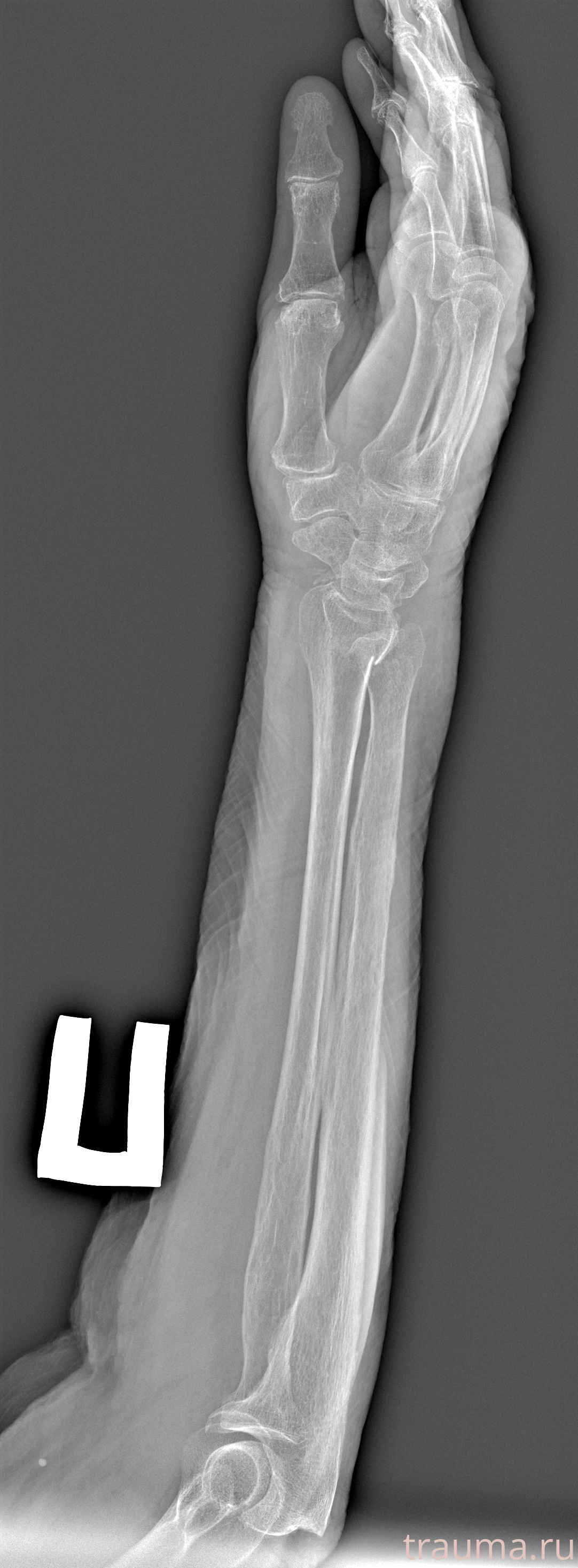 Рентген на дому: по вашему адресу приезжает врач-рентгенолог, травматолог-ортопед с мобильным рентгеновским аппаратом, проводит диагностику травмы или заболевания, делает необходимые рентгенограммы, дает рекомендации по дальнейшему лечению. Получить качественные снимки в домашних условиях возможно благодаря уникальной методике, разработанной МосРентген Центром для института  Склифосовского