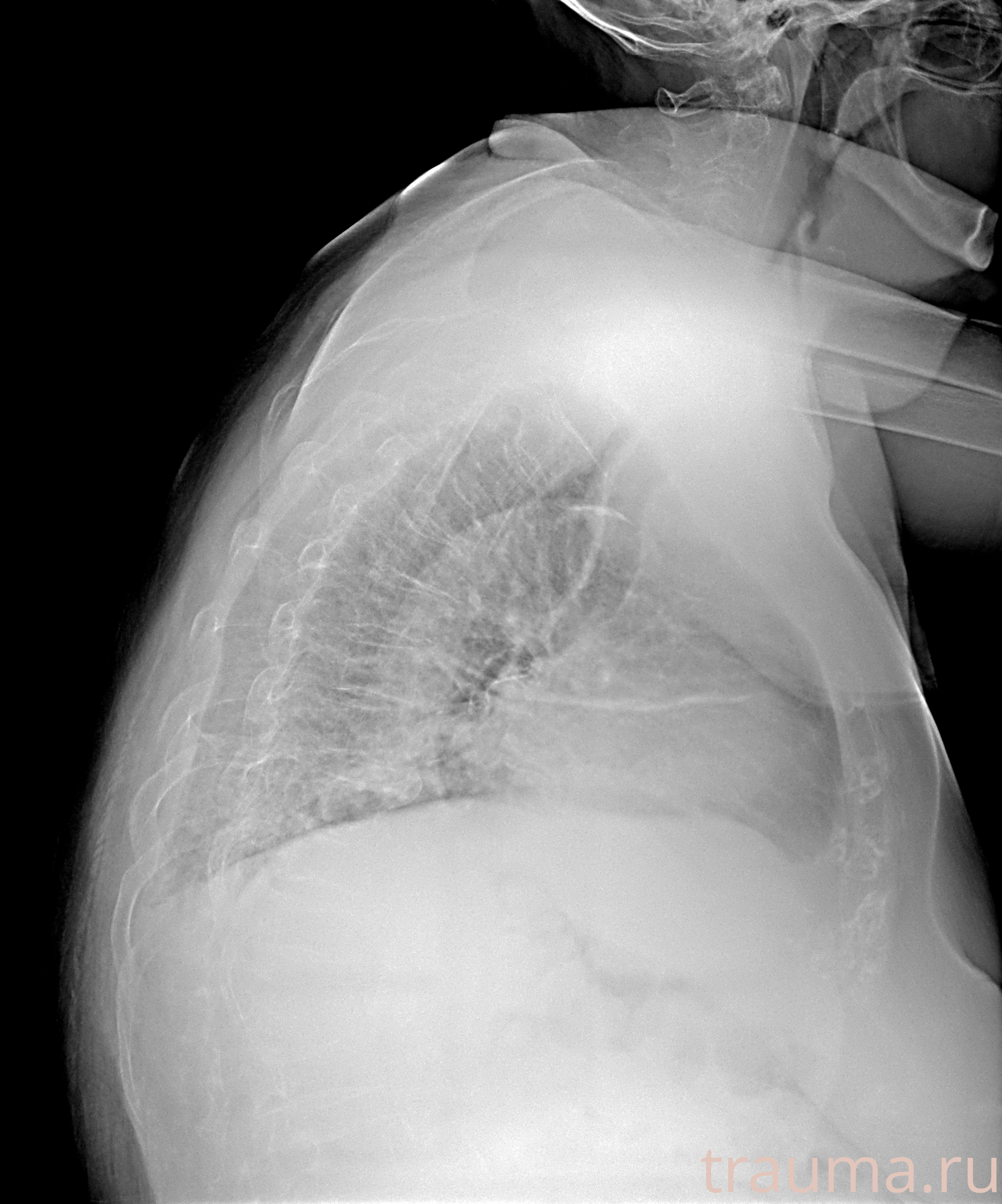 Рентген на дому: по вашему адресу приезжает врач-рентгенолог, травматолог-ортопед с мобильным рентгеновским аппаратом, проводит диагностику травмы или заболевания, делает необходимые рентгенограммы, дает рекомендации по дальнейшему лечению. Получить качественные снимки в домашних условиях возможно благодаря уникальной методике, разработанной МосРентген Центром для института  Склифосовского