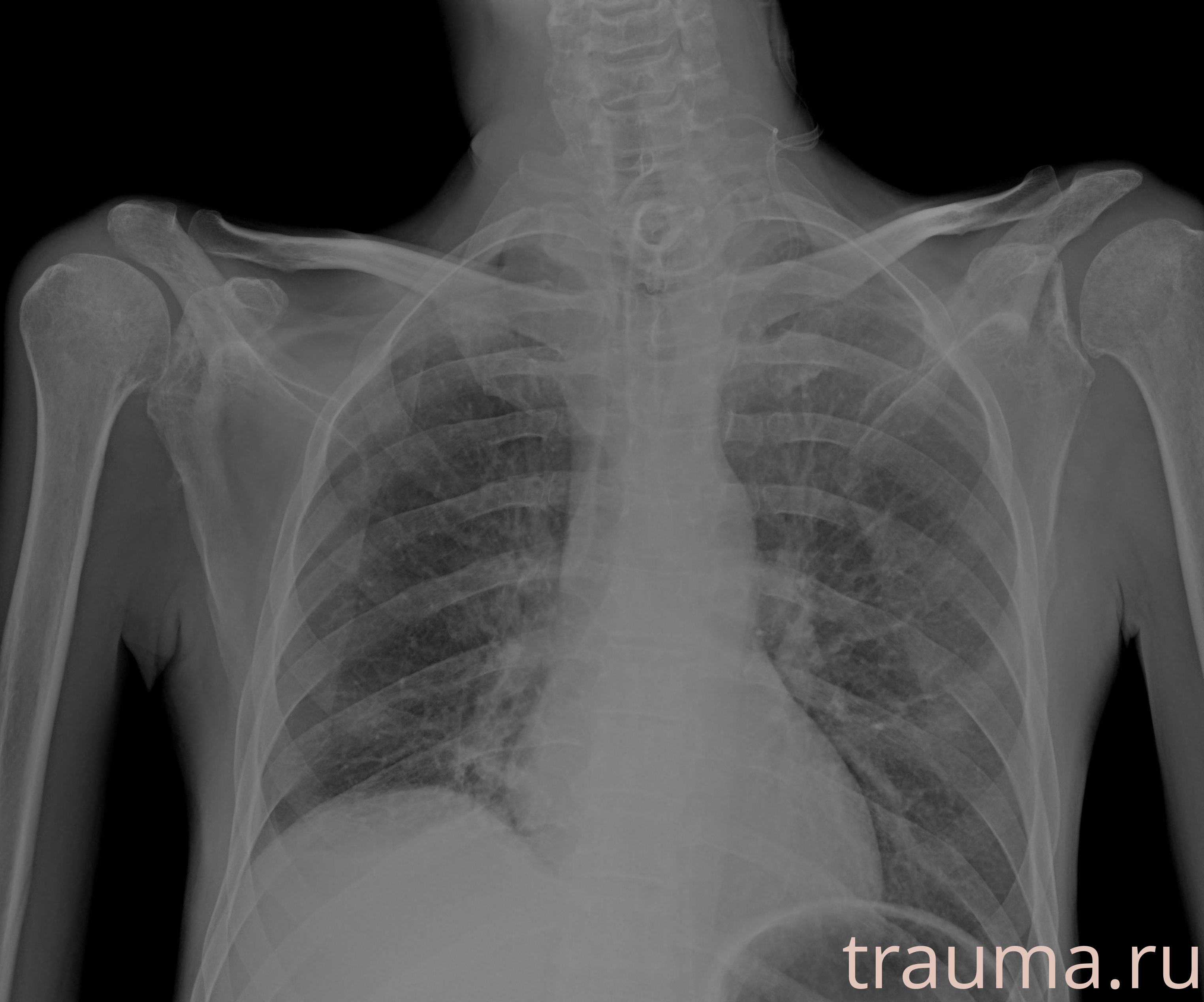 Рентген на дому: по вашему адресу приезжает врач-рентгенолог, травматолог-ортопед с мобильным рентгеновским аппаратом, проводит диагностику травмы или заболевания, делает необходимые рентгенограммы, дает рекомендации по дальнейшему лечению. Получить качественные снимки в домашних условиях возможно благодаря уникальной методике, разработанной МосРентген Центром для института  Склифосовского