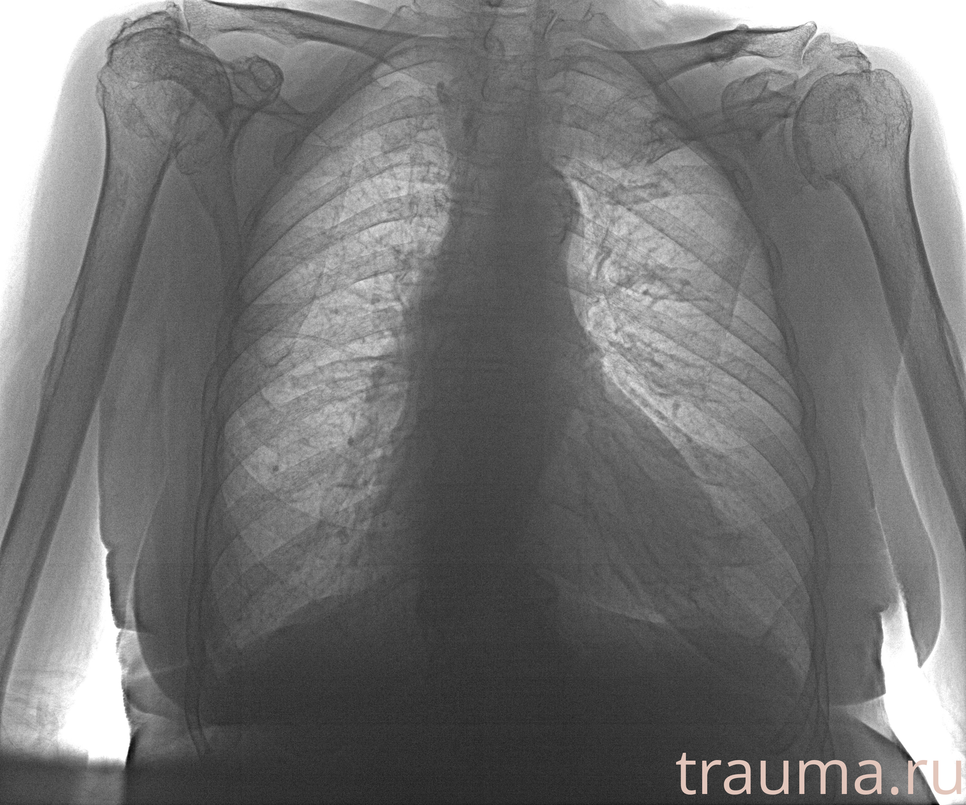 Рентген на дому: по вашему адресу приезжает врач-рентгенолог, травматолог-ортопед с мобильным рентгеновским аппаратом, проводит диагностику травмы или заболевания, делает необходимые рентгенограммы, дает рекомендации по дальнейшему лечению. Получить качественные снимки в домашних условиях возможно благодаря уникальной методике, разработанной МосРентген Центром для института  Склифосовского