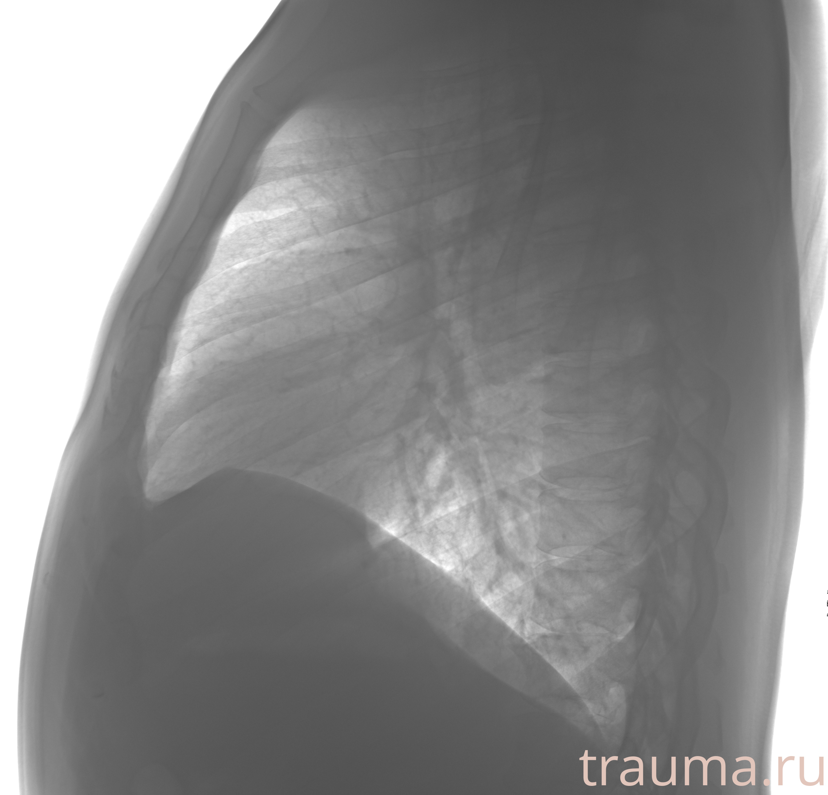 Рентген на дому: по вашему адресу приезжает врач-рентгенолог, травматолог-ортопед с мобильным рентгеновским аппаратом, проводит диагностику травмы или заболевания, делает необходимые рентгенограммы, дает рекомендации по дальнейшему лечению. Получить качественные снимки в домашних условиях возможно благодаря уникальной методике, разработанной МосРентген Центром для института  Склифосовского