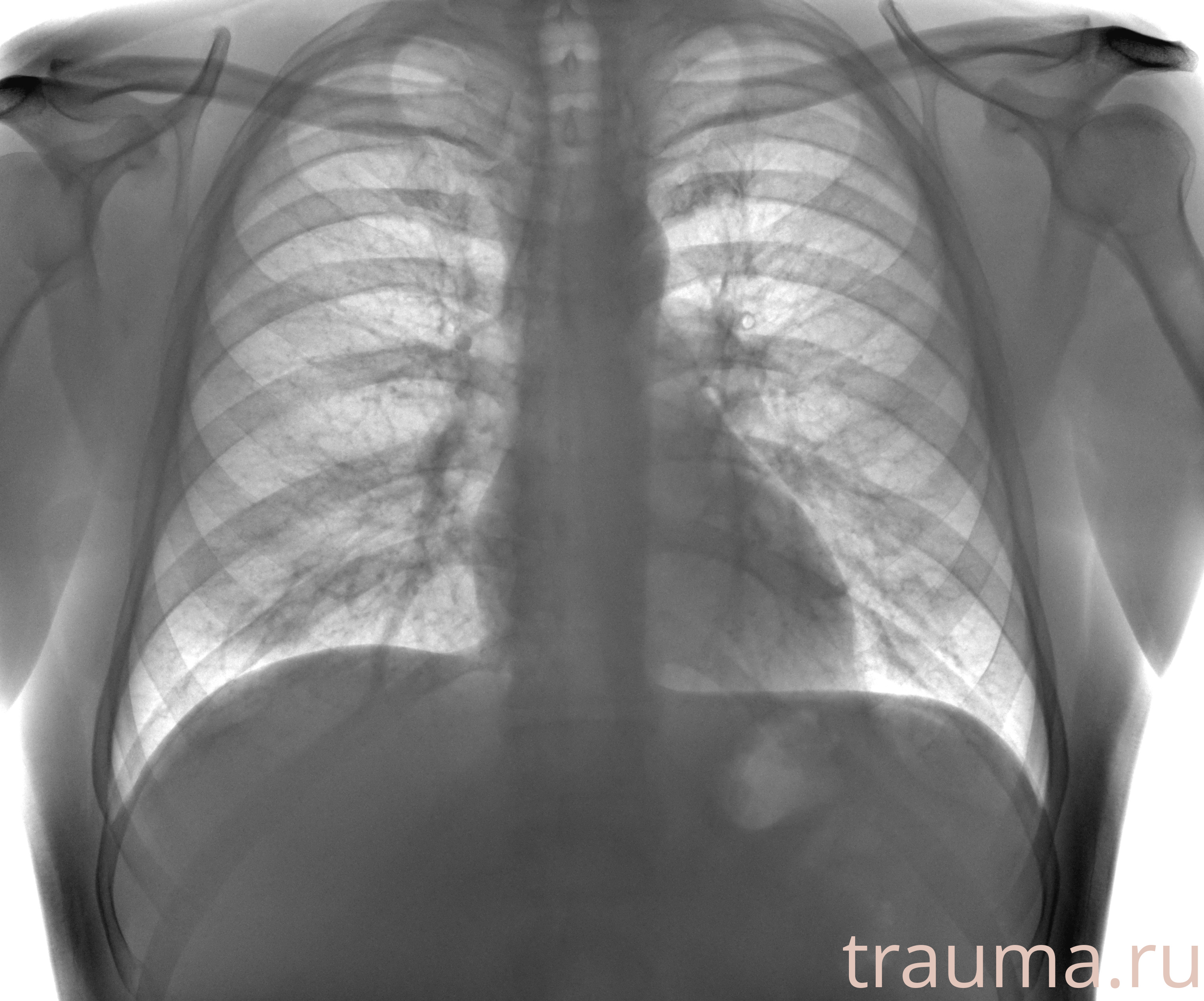 Рентген на дому: по вашему адресу приезжает врач-рентгенолог, травматолог-ортопед с мобильным рентгеновским аппаратом, проводит диагностику травмы или заболевания, делает необходимые рентгенограммы, дает рекомендации по дальнейшему лечению. Получить качественные снимки в домашних условиях возможно благодаря уникальной методике, разработанной МосРентген Центром для института  Склифосовского