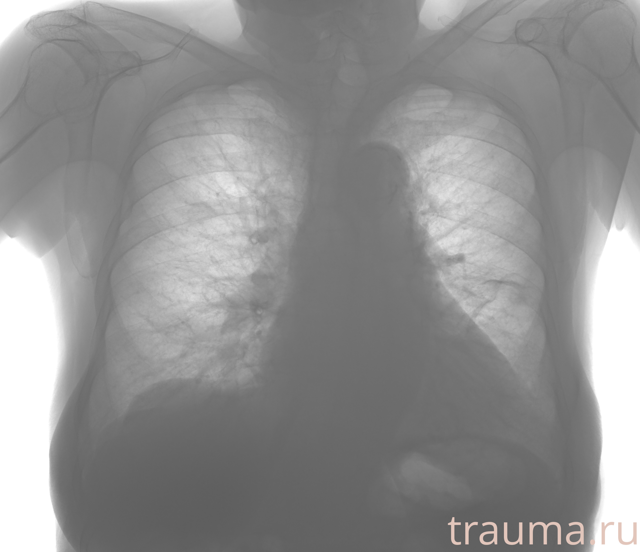 Рентген на дому: по вашему адресу приезжает врач-рентгенолог, травматолог-ортопед с мобильным рентгеновским аппаратом, проводит диагностику травмы или заболевания, делает необходимые рентгенограммы, дает рекомендации по дальнейшему лечению. Получить качественные снимки в домашних условиях возможно благодаря уникальной методике, разработанной МосРентген Центром для института  Склифосовского