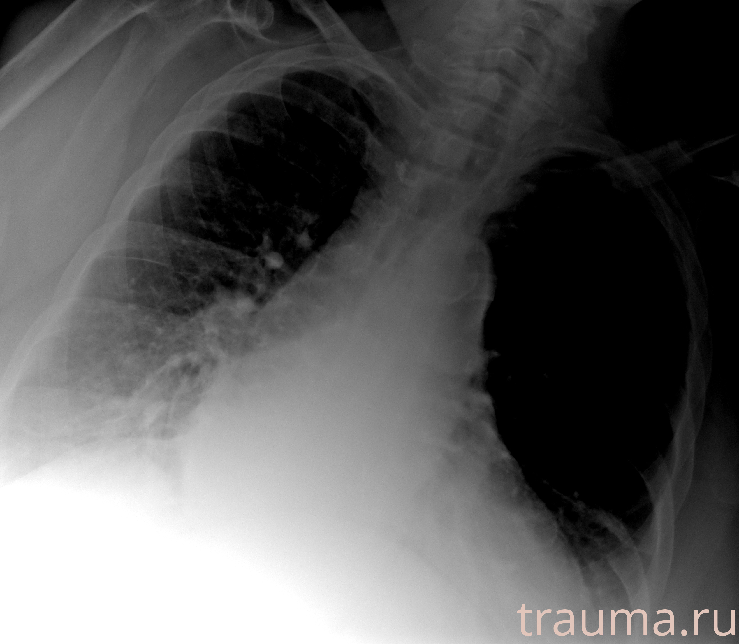 Рентген на дому: по вашему адресу приезжает врач-рентгенолог, травматолог-ортопед с мобильным рентгеновским аппаратом, проводит диагностику травмы или заболевания, делает необходимые рентгенограммы, дает рекомендации по дальнейшему лечению. Получить качественные снимки в домашних условиях возможно благодаря уникальной методике, разработанной МосРентген Центром для института  Склифосовского