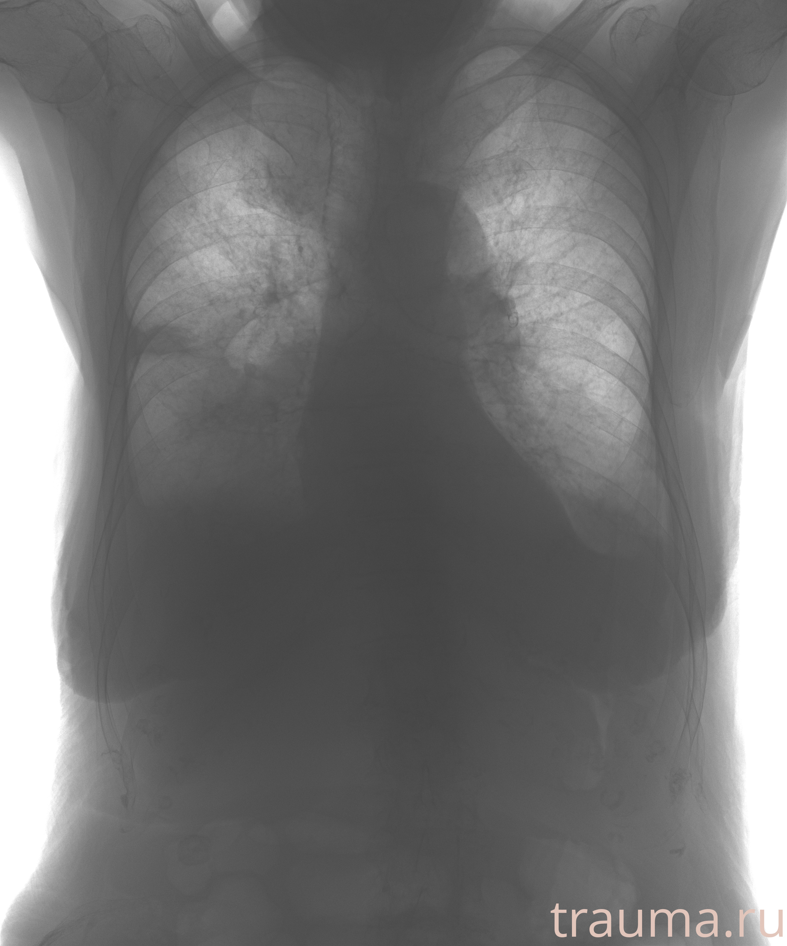 Рентген на дому: по вашему адресу приезжает врач-рентгенолог, травматолог-ортопед с мобильным рентгеновским аппаратом, проводит диагностику травмы или заболевания, делает необходимые рентгенограммы, дает рекомендации по дальнейшему лечению. Получить качественные снимки в домашних условиях возможно благодаря уникальной методике, разработанной МосРентген Центром для института  Склифосовского