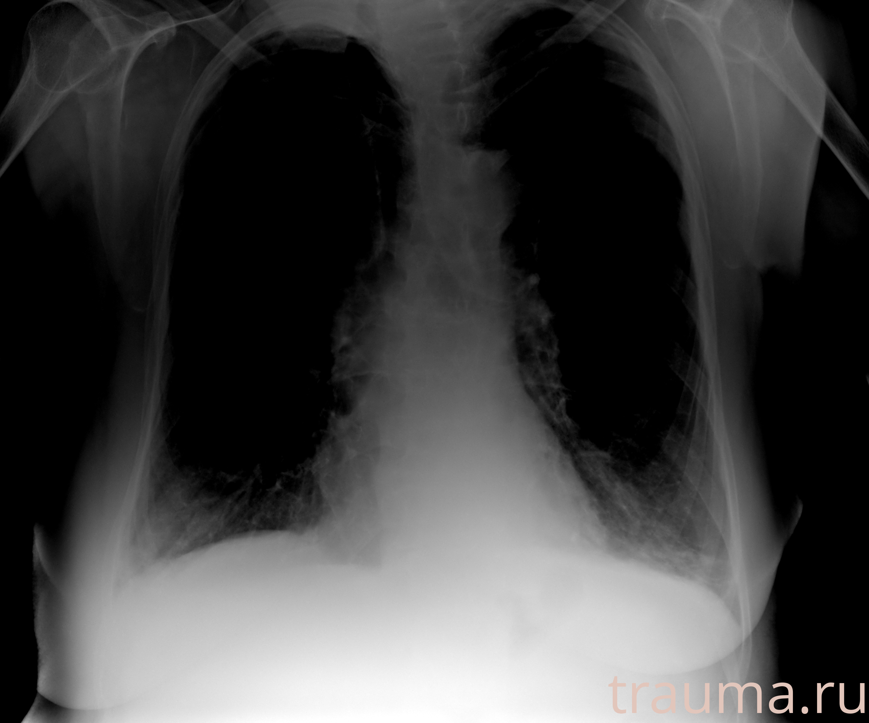 Рентген на дому: по вашему адресу приезжает врач-рентгенолог, травматолог-ортопед с мобильным рентгеновским аппаратом, проводит диагностику травмы или заболевания, делает необходимые рентгенограммы, дает рекомендации по дальнейшему лечению. Получить качественные снимки в домашних условиях возможно благодаря уникальной методике, разработанной МосРентген Центром для института  Склифосовского