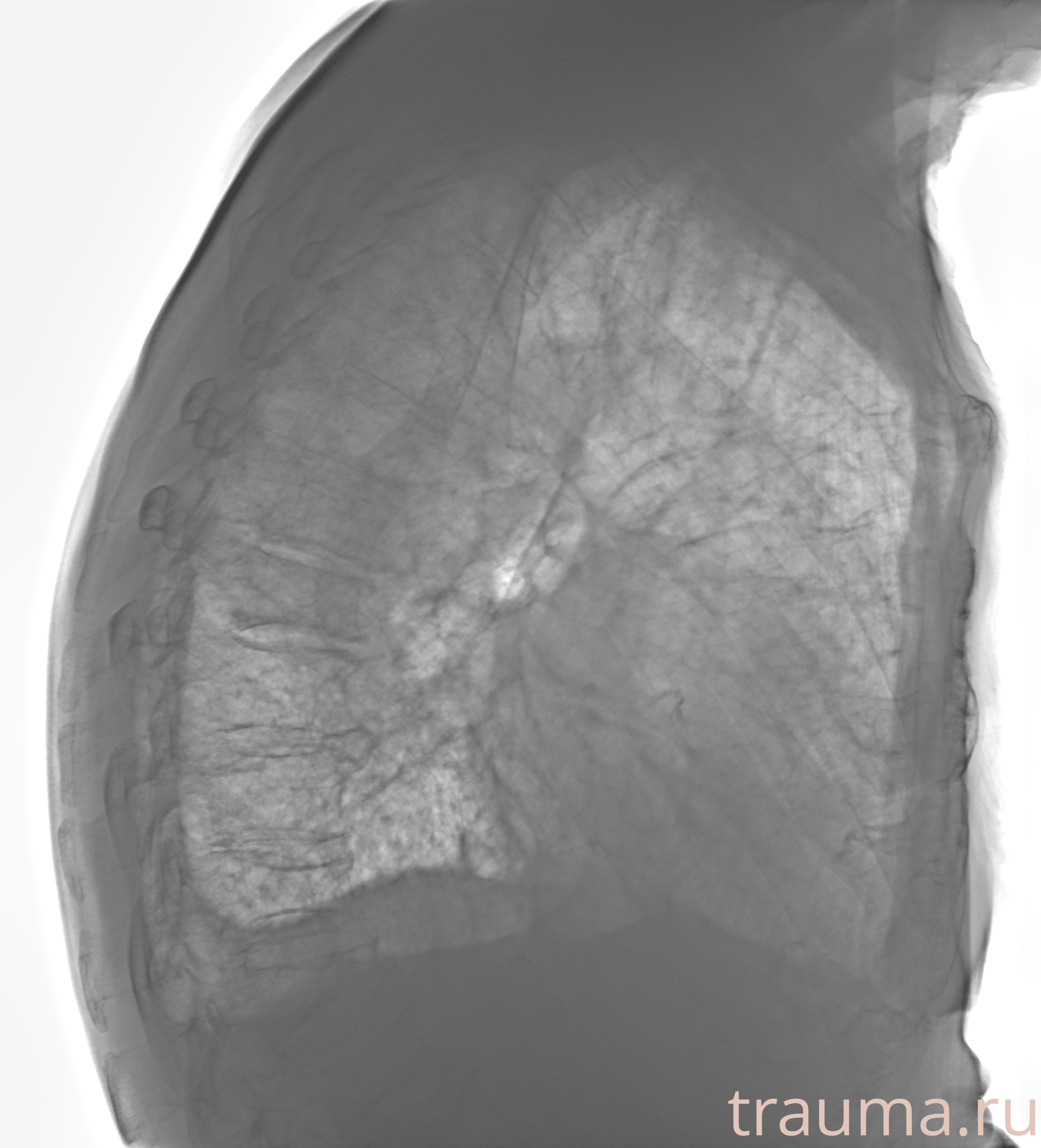 Рентген на дому: по вашему адресу приезжает врач-рентгенолог, травматолог-ортопед с мобильным рентгеновским аппаратом, проводит диагностику травмы или заболевания, делает необходимые рентгенограммы, дает рекомендации по дальнейшему лечению. Получить качественные снимки в домашних условиях возможно благодаря уникальной методике, разработанной МосРентген Центром для института  Склифосовского