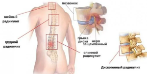 Ученые дают рекомендации по занятиям сексом для мужчин с больной спиной