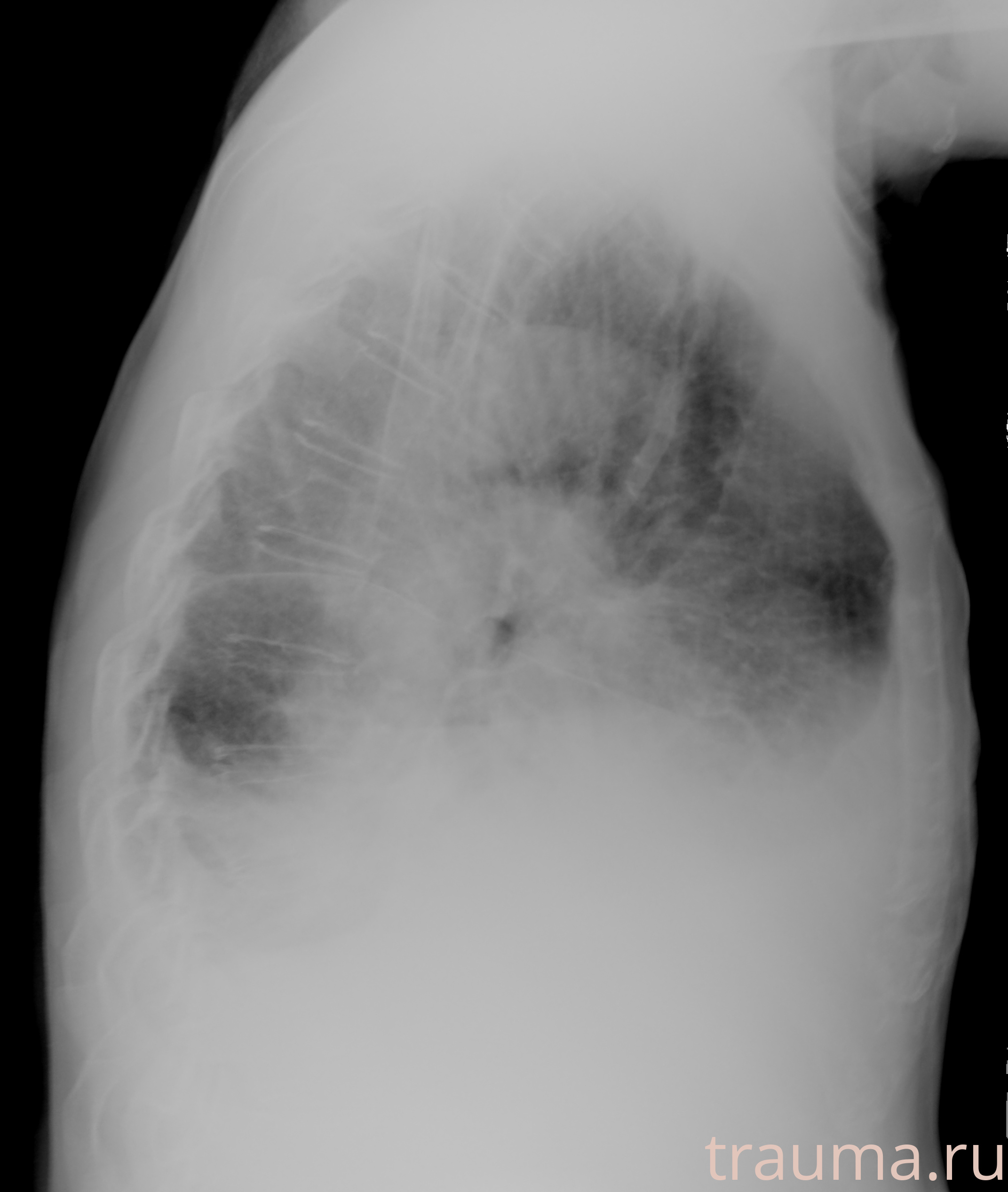 Рентген на дому: по вашему адресу приезжает врач-рентгенолог, травматолог-ортопед с мобильным рентгеновским аппаратом, проводит диагностику травмы или заболевания, делает необходимые рентгенограммы, дает рекомендации по дальнейшему лечению. Получить качественные снимки в домашних условиях возможно благодаря уникальной методике, разработанной МосРентген Центром для института  Склифосовского