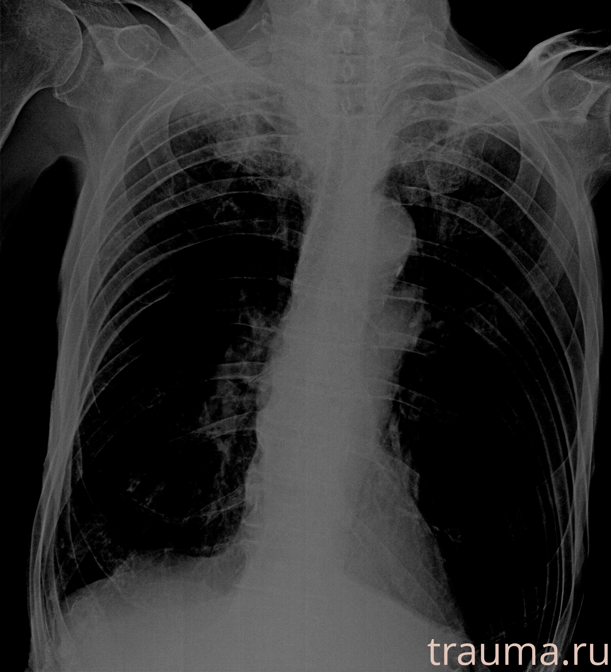 Рентген на дому: по вашему адресу приезжает врач-рентгенолог, травматолог-ортопед с мобильным рентгеновским аппаратом, проводит диагностику травмы или заболевания, делает необходимые рентгенограммы, дает рекомендации по дальнейшему лечению. Получить качественные снимки в домашних условиях возможно благодаря уникальной методике, разработанной МосРентген Центром для института  Склифосовского