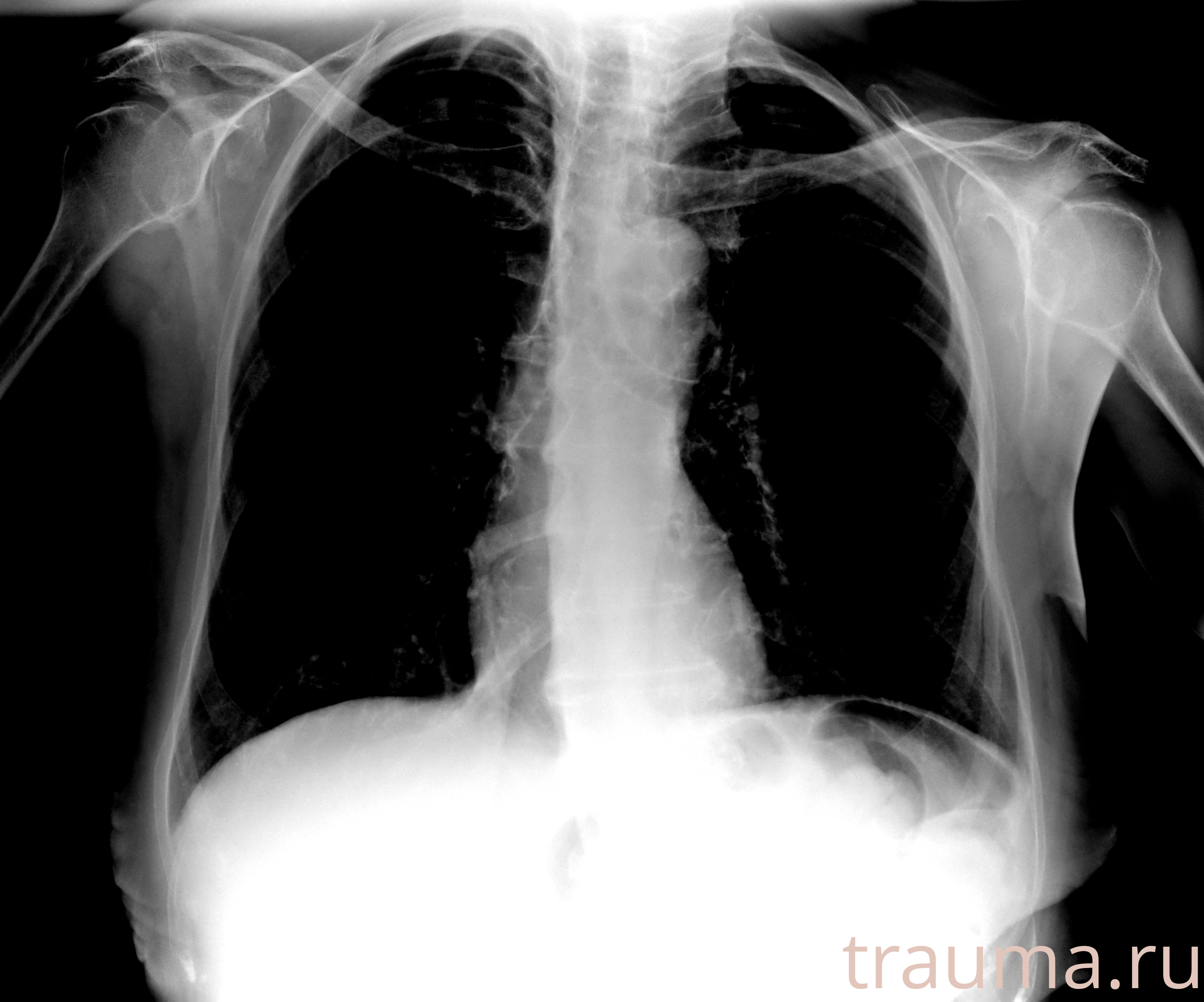 Рентген на дому: по вашему адресу приезжает врач-рентгенолог, травматолог-ортопед с мобильным рентгеновским аппаратом, проводит диагностику травмы или заболевания, делает необходимые рентгенограммы, дает рекомендации по дальнейшему лечению. Получить качественные снимки в домашних условиях возможно благодаря уникальной методике, разработанной МосРентген Центром для института  Склифосовского