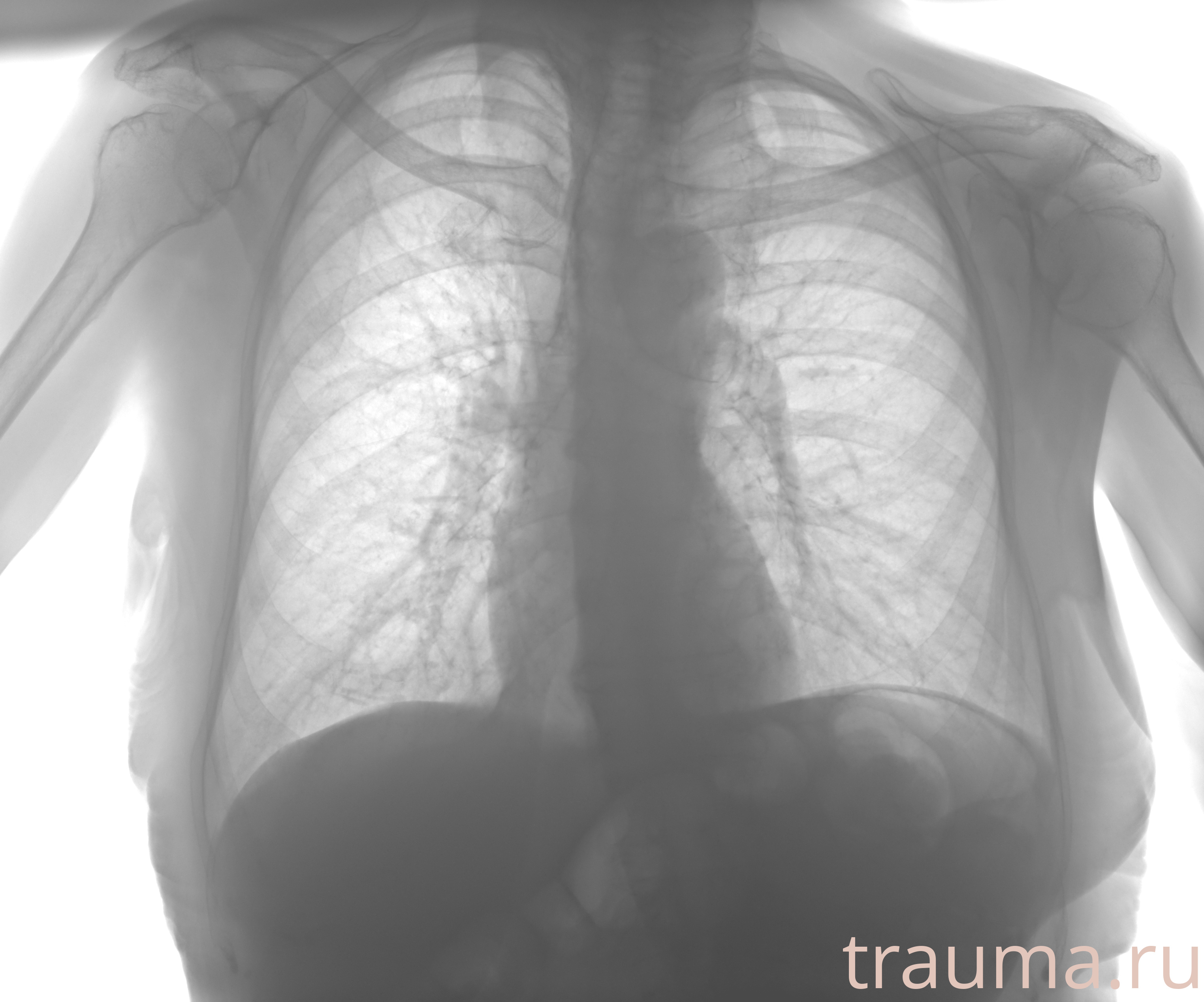 Рентген на дому: по вашему адресу приезжает врач-рентгенолог, травматолог-ортопед с мобильным рентгеновским аппаратом, проводит диагностику травмы или заболевания, делает необходимые рентгенограммы, дает рекомендации по дальнейшему лечению. Получить качественные снимки в домашних условиях возможно благодаря уникальной методике, разработанной МосРентген Центром для института  Склифосовского