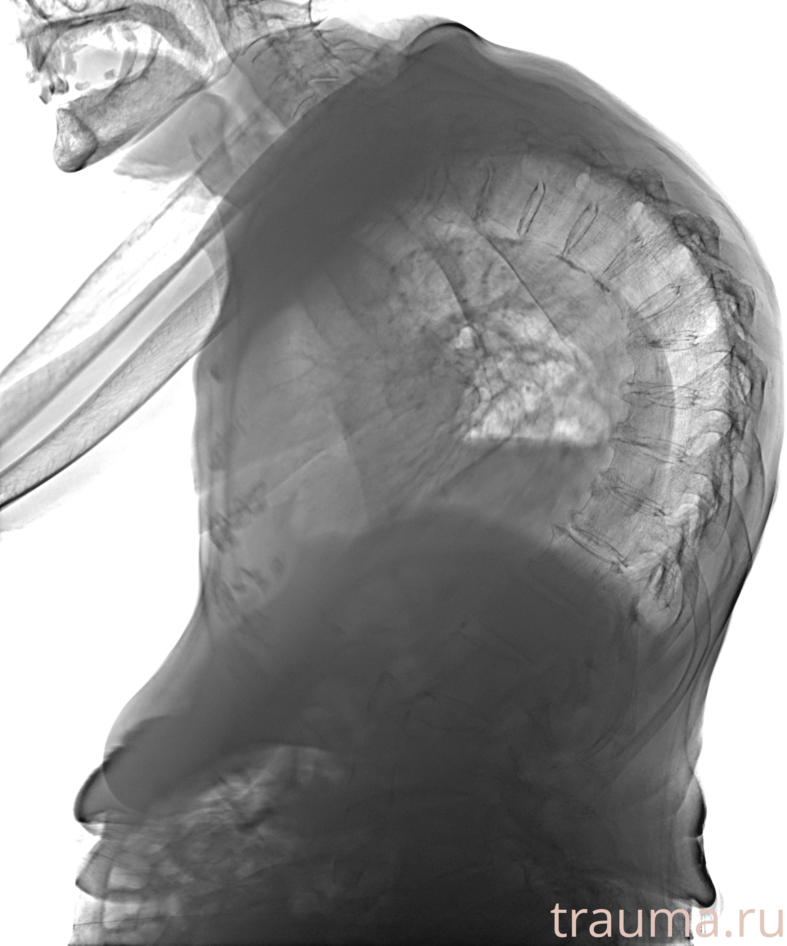 Рентген на дому: по вашему адресу приезжает врач-рентгенолог, травматолог-ортопед с мобильным рентгеновским аппаратом, проводит диагностику травмы или заболевания, делает необходимые рентгенограммы, дает рекомендации по дальнейшему лечению. Получить качественные снимки в домашних условиях возможно благодаря уникальной методике, разработанной МосРентген Центром для института  Склифосовского