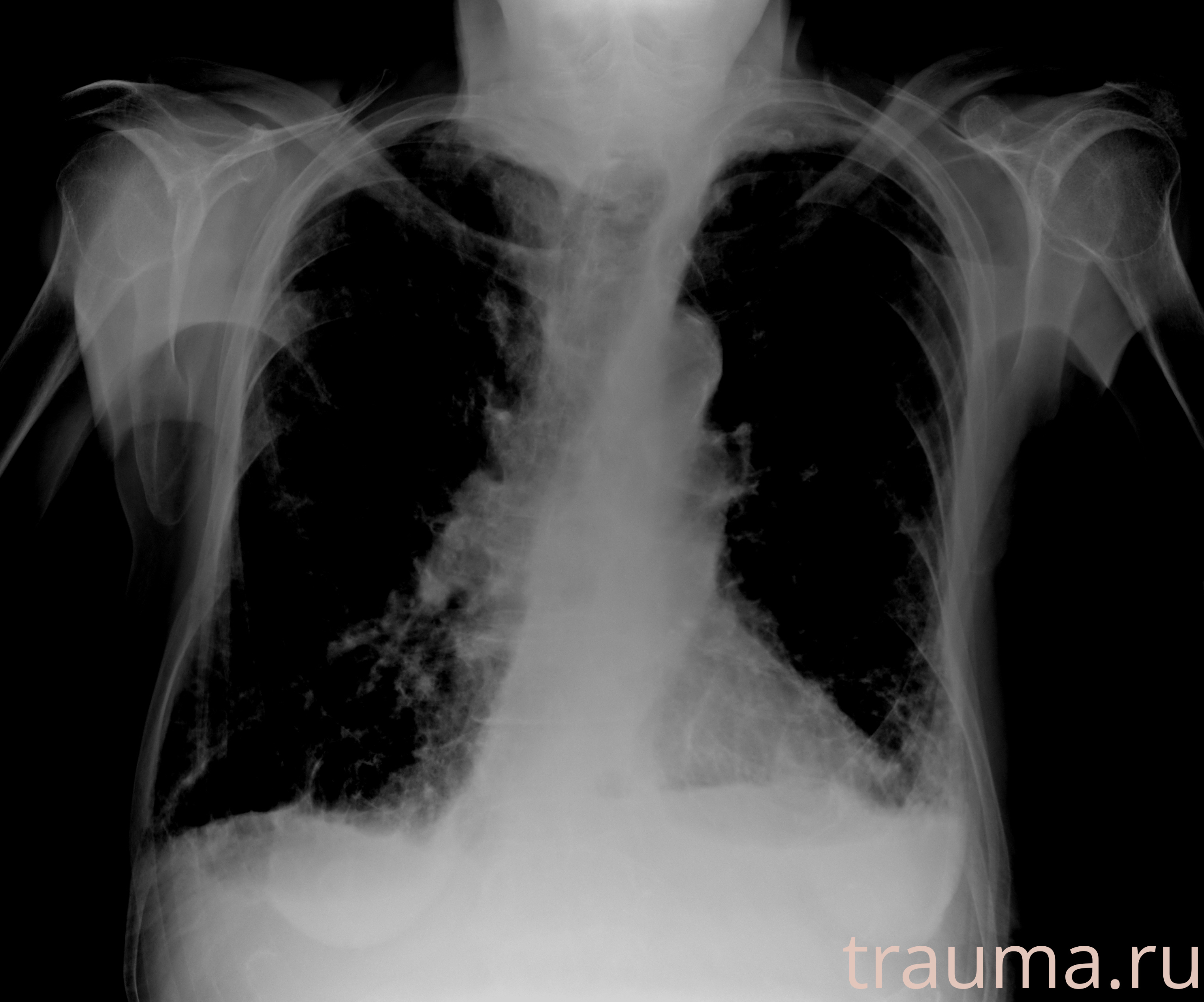 Рентген на дому: по вашему адресу приезжает врач-рентгенолог, травматолог-ортопед с мобильным рентгеновским аппаратом, проводит диагностику травмы или заболевания, делает необходимые рентгенограммы, дает рекомендации по дальнейшему лечению. Получить качественные снимки в домашних условиях возможно благодаря уникальной методике, разработанной МосРентген Центром для института  Склифосовского