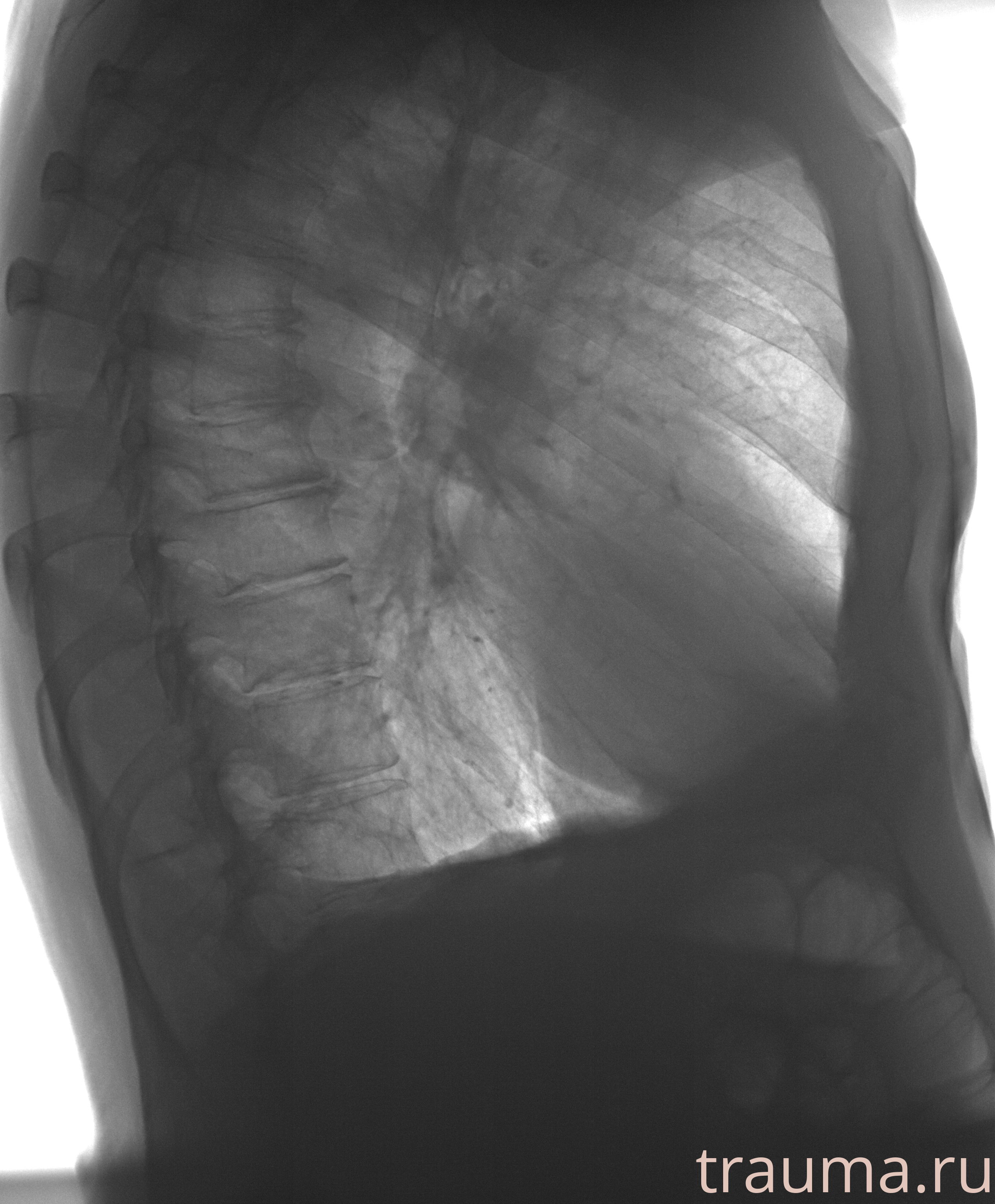 Рентген на дому: по вашему адресу приезжает врач-рентгенолог, травматолог-ортопед с мобильным рентгеновским аппаратом, проводит диагностику травмы или заболевания, делает необходимые рентгенограммы, дает рекомендации по дальнейшему лечению. Получить качественные снимки в домашних условиях возможно благодаря уникальной методике, разработанной МосРентген Центром для института  Склифосовского
