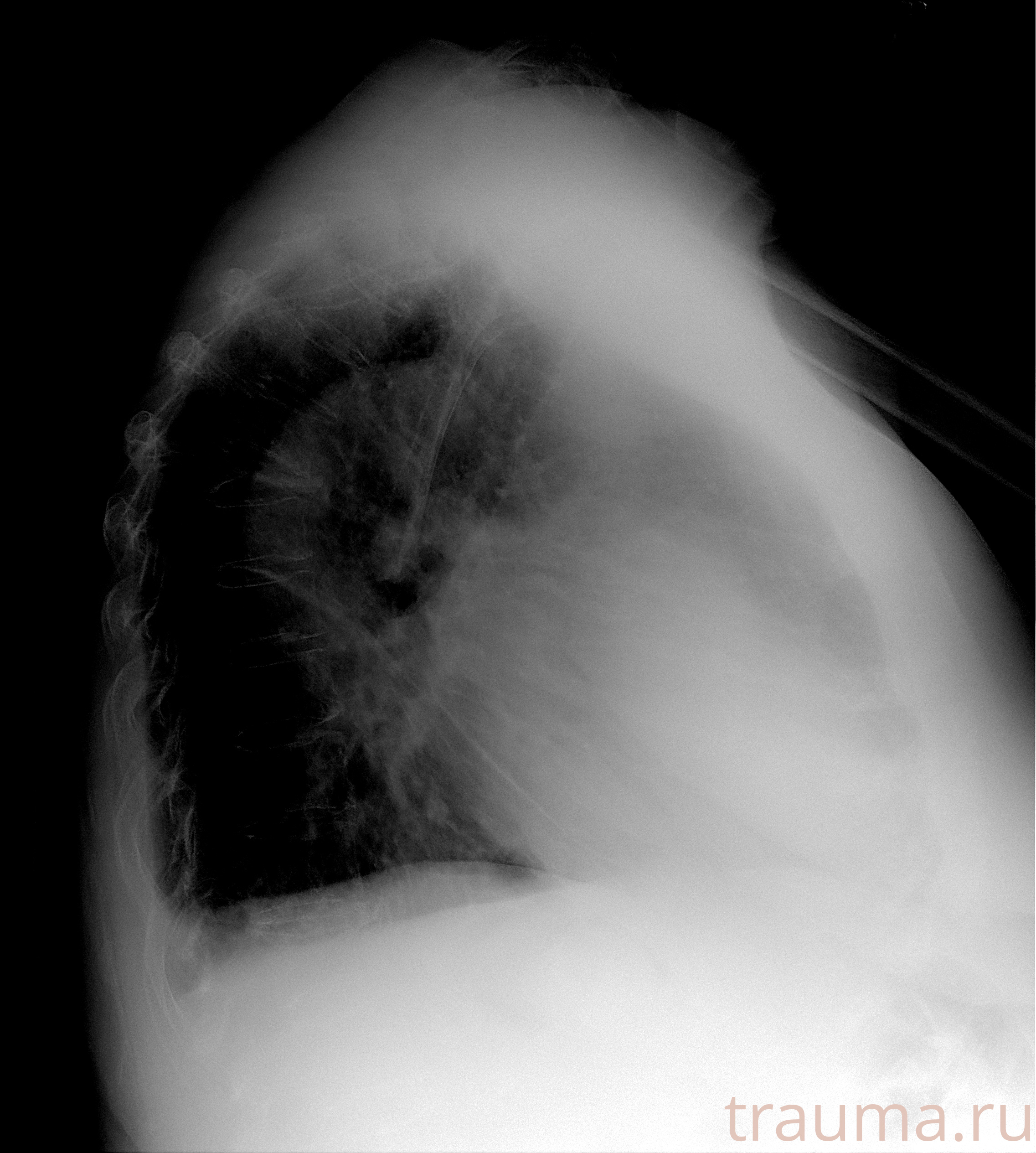 Рентген на дому: по вашему адресу приезжает врач-рентгенолог, травматолог-ортопед с мобильным рентгеновским аппаратом, проводит диагностику травмы или заболевания, делает необходимые рентгенограммы, дает рекомендации по дальнейшему лечению. Получить качественные снимки в домашних условиях возможно благодаря уникальной методике, разработанной МосРентген Центром для института  Склифосовского