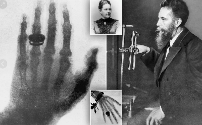 Ученые придумали, как сделать рентген эффективнее