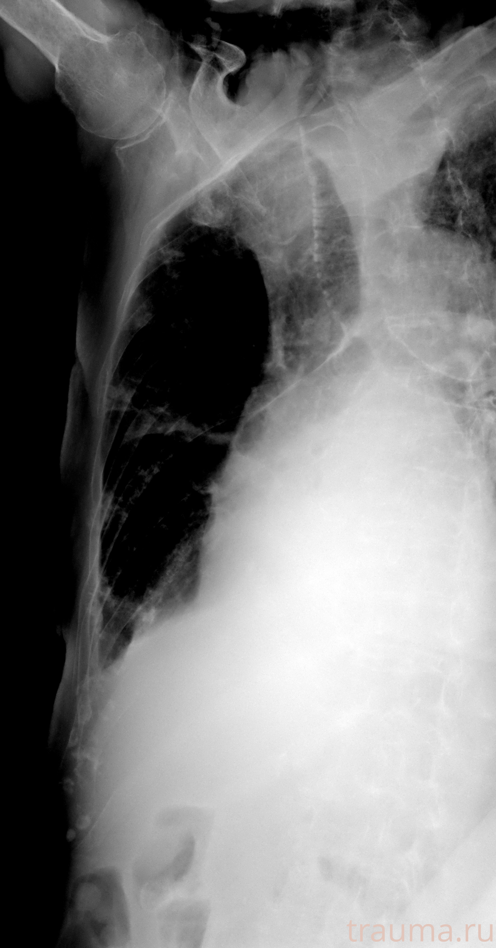 Рентген на дому: по вашему адресу приезжает врач-рентгенолог, травматолог-ортопед с мобильным рентгеновским аппаратом, проводит диагностику травмы или заболевания, делает необходимые рентгенограммы, дает рекомендации по дальнейшему лечению. Получить качественные снимки в домашних условиях возможно благодаря уникальной методике, разработанной МосРентген Центром для института  Склифосовского