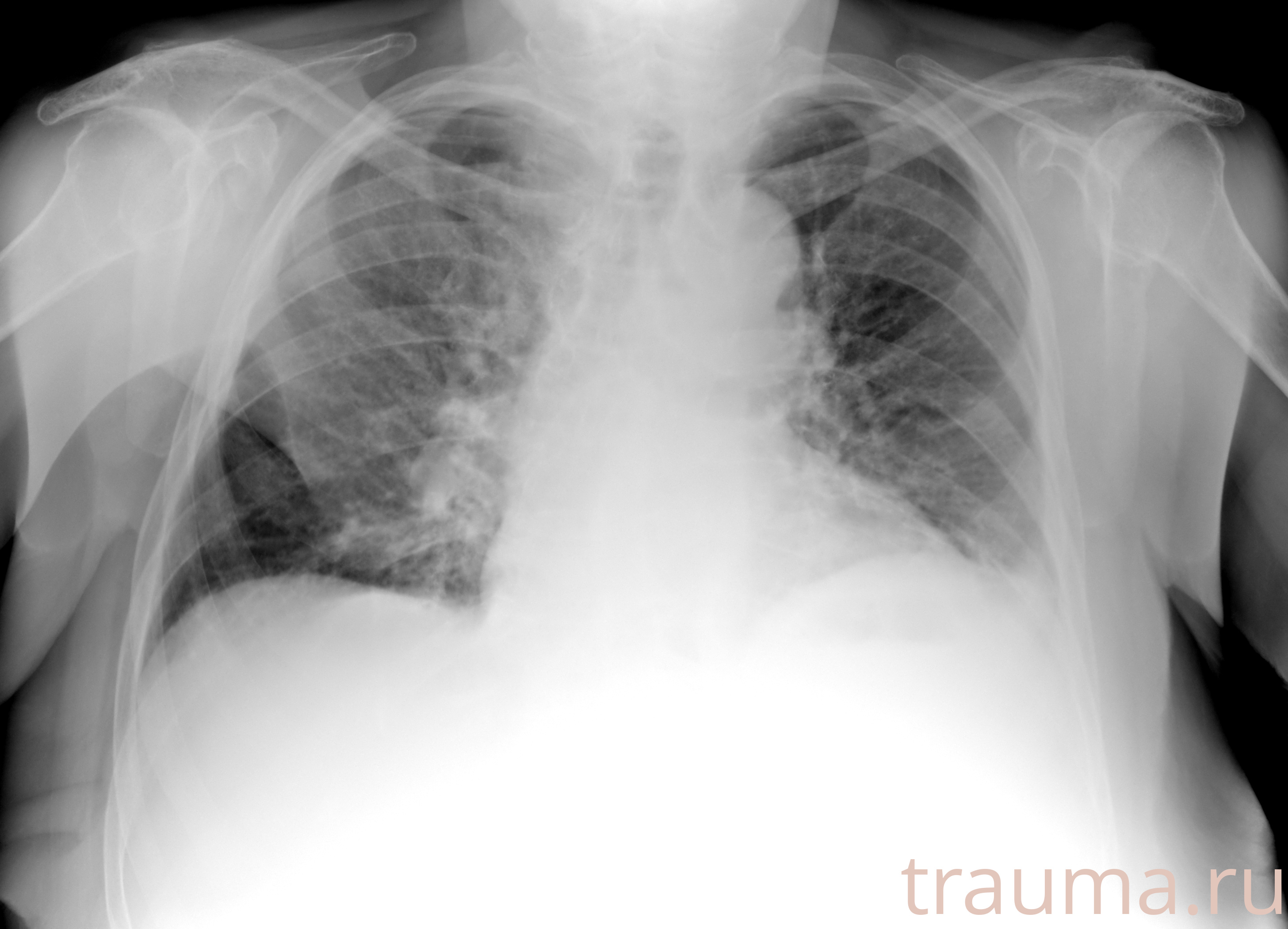 Рентген на дому: по вашему адресу приезжает врач-рентгенолог, травматолог-ортопед с мобильным рентгеновским аппаратом, проводит диагностику травмы или заболевания, делает необходимые рентгенограммы, дает рекомендации по дальнейшему лечению. Получить качественные снимки в домашних условиях возможно благодаря уникальной методике, разработанной МосРентген Центром для института  Склифосовского