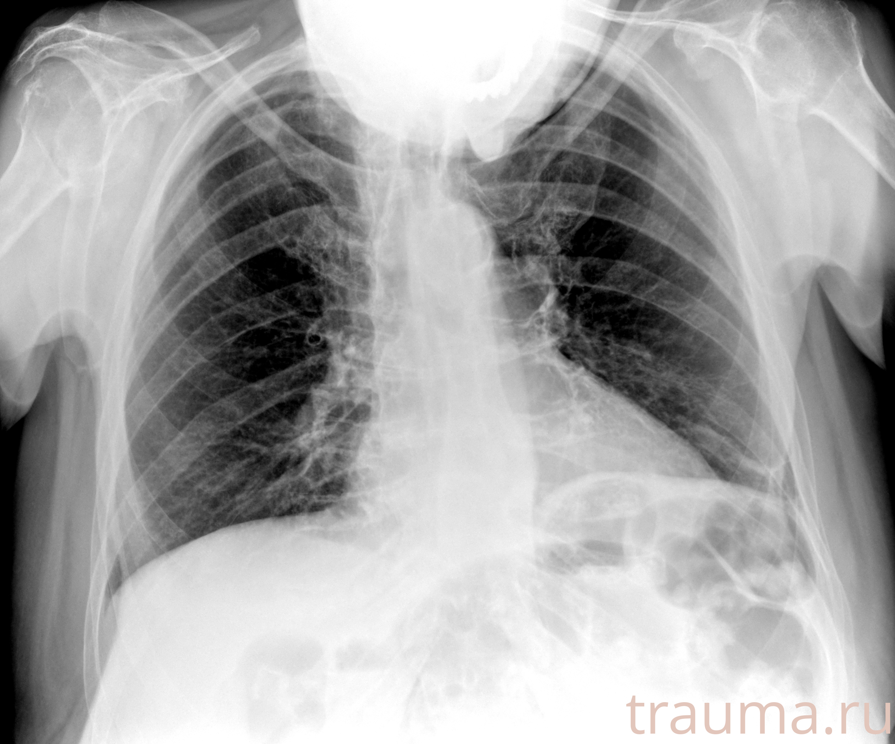 Рентген на дому: по вашему адресу приезжает врач-рентгенолог, травматолог-ортопед с мобильным рентгеновским аппаратом, проводит диагностику травмы или заболевания, делает необходимые рентгенограммы, дает рекомендации по дальнейшему лечению. Получить качественные снимки в домашних условиях возможно благодаря уникальной методике, разработанной МосРентген Центром для института  Склифосовского