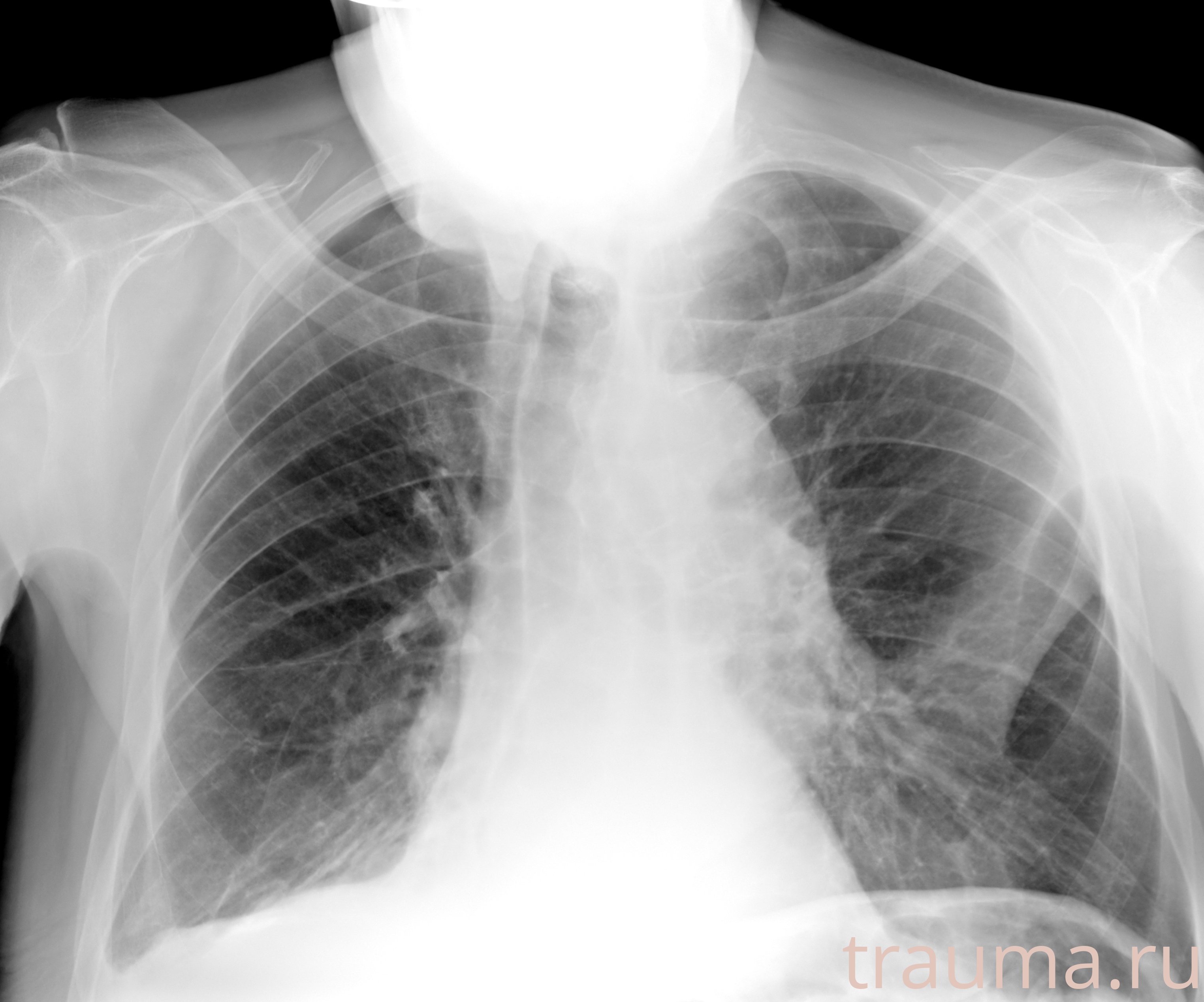 Рентген на дому: по вашему адресу приезжает врач-рентгенолог, травматолог-ортопед с мобильным рентгеновским аппаратом, проводит диагностику травмы или заболевания, делает необходимые рентгенограммы, дает рекомендации по дальнейшему лечению. Получить качественные снимки в домашних условиях возможно благодаря уникальной методике, разработанной МосРентген Центром для института  Склифосовского