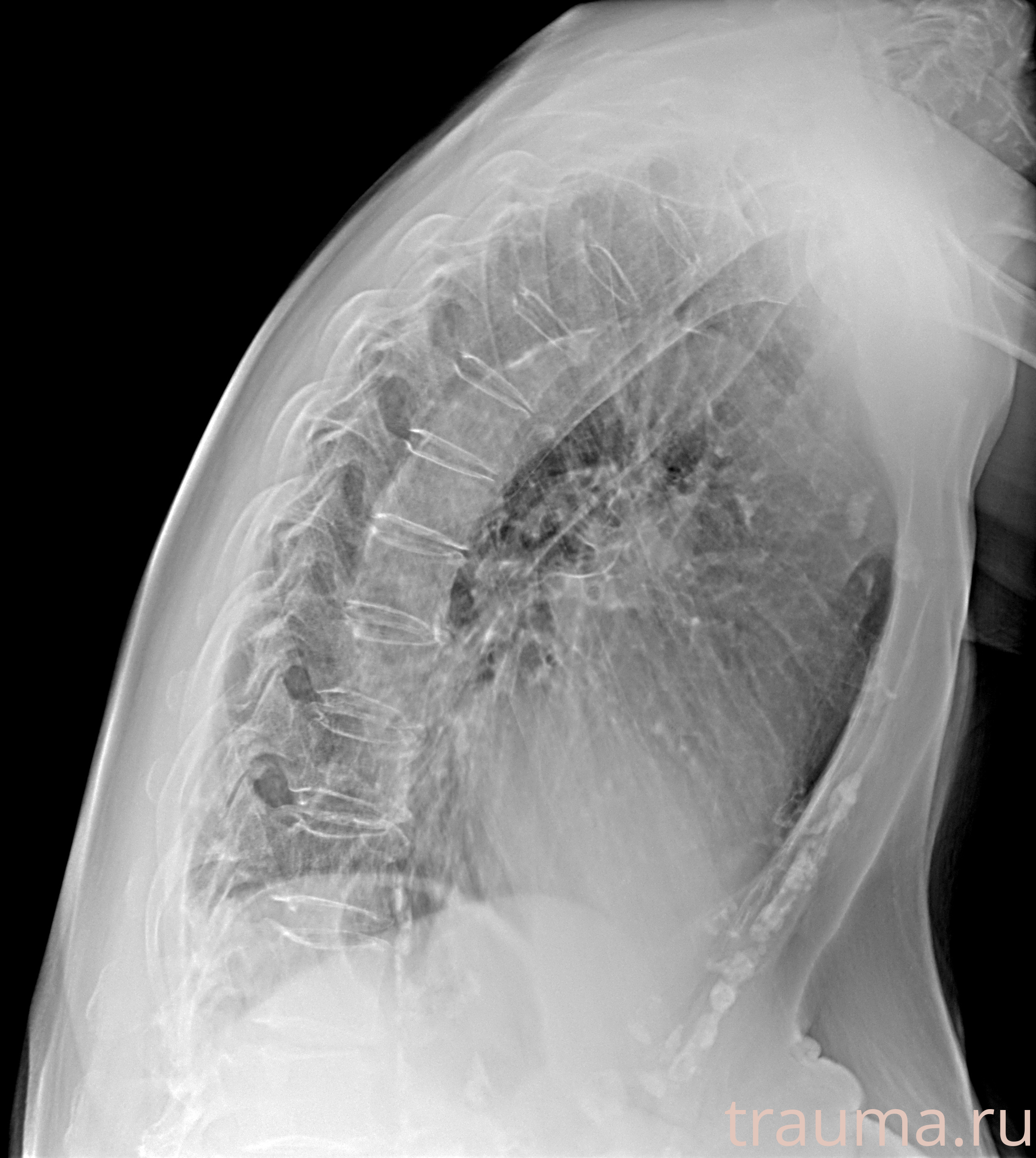 Рентген на дому: по вашему адресу приезжает врач-рентгенолог, травматолог-ортопед с мобильным рентгеновским аппаратом, проводит диагностику травмы или заболевания, делает необходимые рентгенограммы, дает рекомендации по дальнейшему лечению. Получить качественные снимки в домашних условиях возможно благодаря уникальной методике, разработанной МосРентген Центром для института  Склифосовского