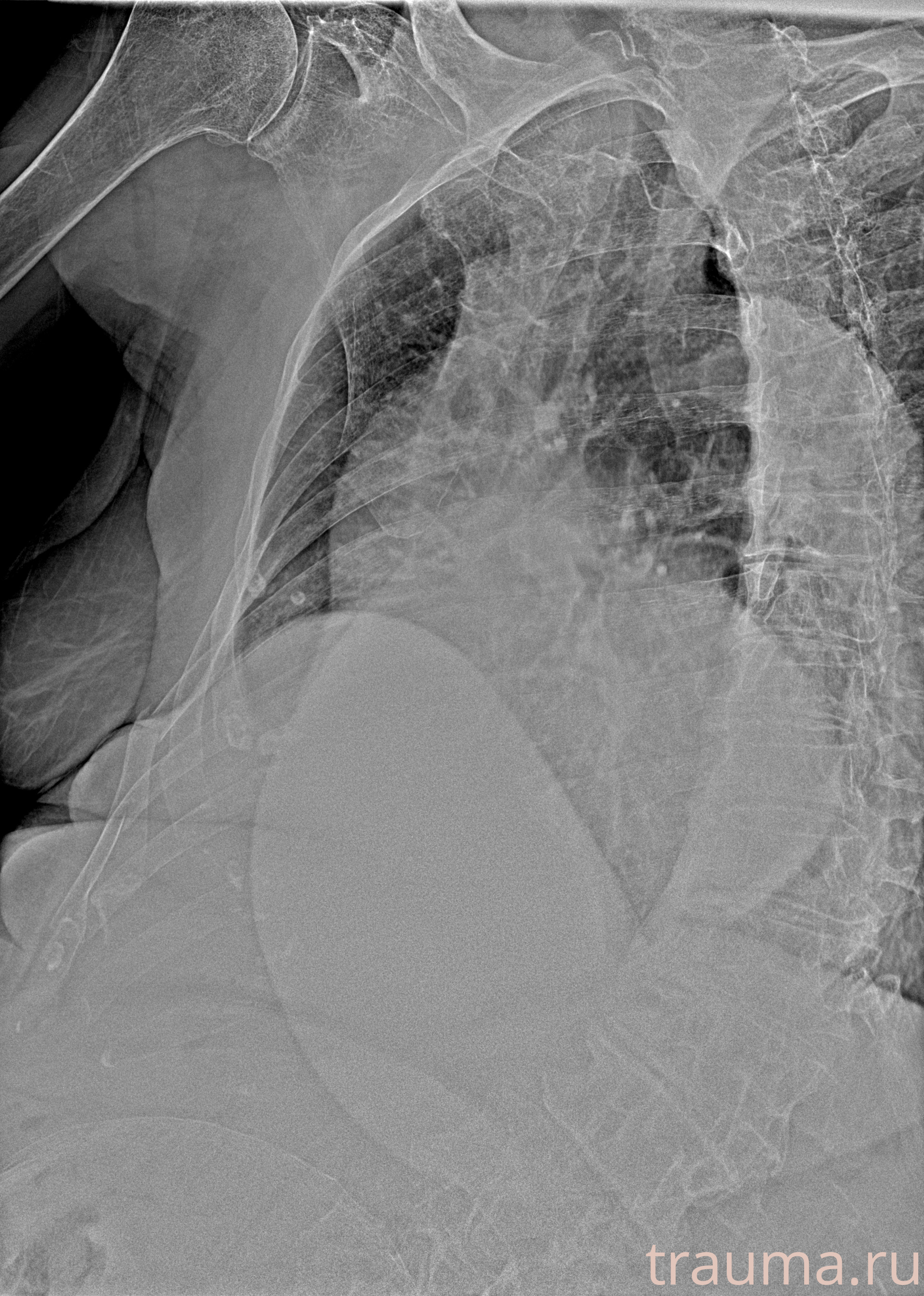Рентген на дому: по вашему адресу приезжает врач-рентгенолог, травматолог-ортопед с мобильным рентгеновским аппаратом, проводит диагностику травмы или заболевания, делает необходимые рентгенограммы, дает рекомендации по дальнейшему лечению. Получить качественные снимки в домашних условиях возможно благодаря уникальной методике, разработанной МосРентген Центром для института  Склифосовского