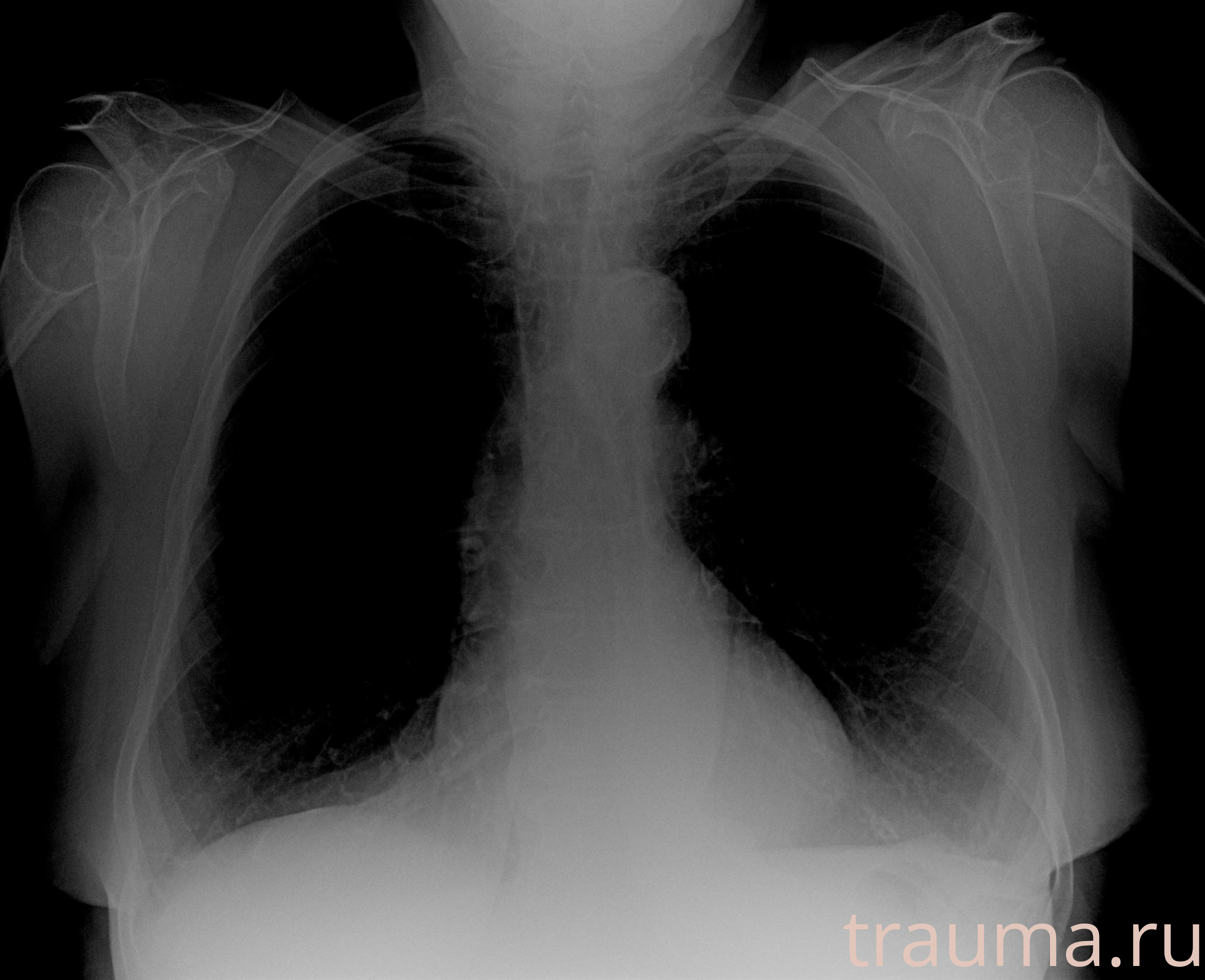 Рентген на дому: по вашему адресу приезжает врач-рентгенолог, травматолог-ортопед с мобильным рентгеновским аппаратом, проводит диагностику травмы или заболевания, делает необходимые рентгенограммы, дает рекомендации по дальнейшему лечению. Получить качественные снимки в домашних условиях возможно благодаря уникальной методике, разработанной МосРентген Центром для института  Склифосовского