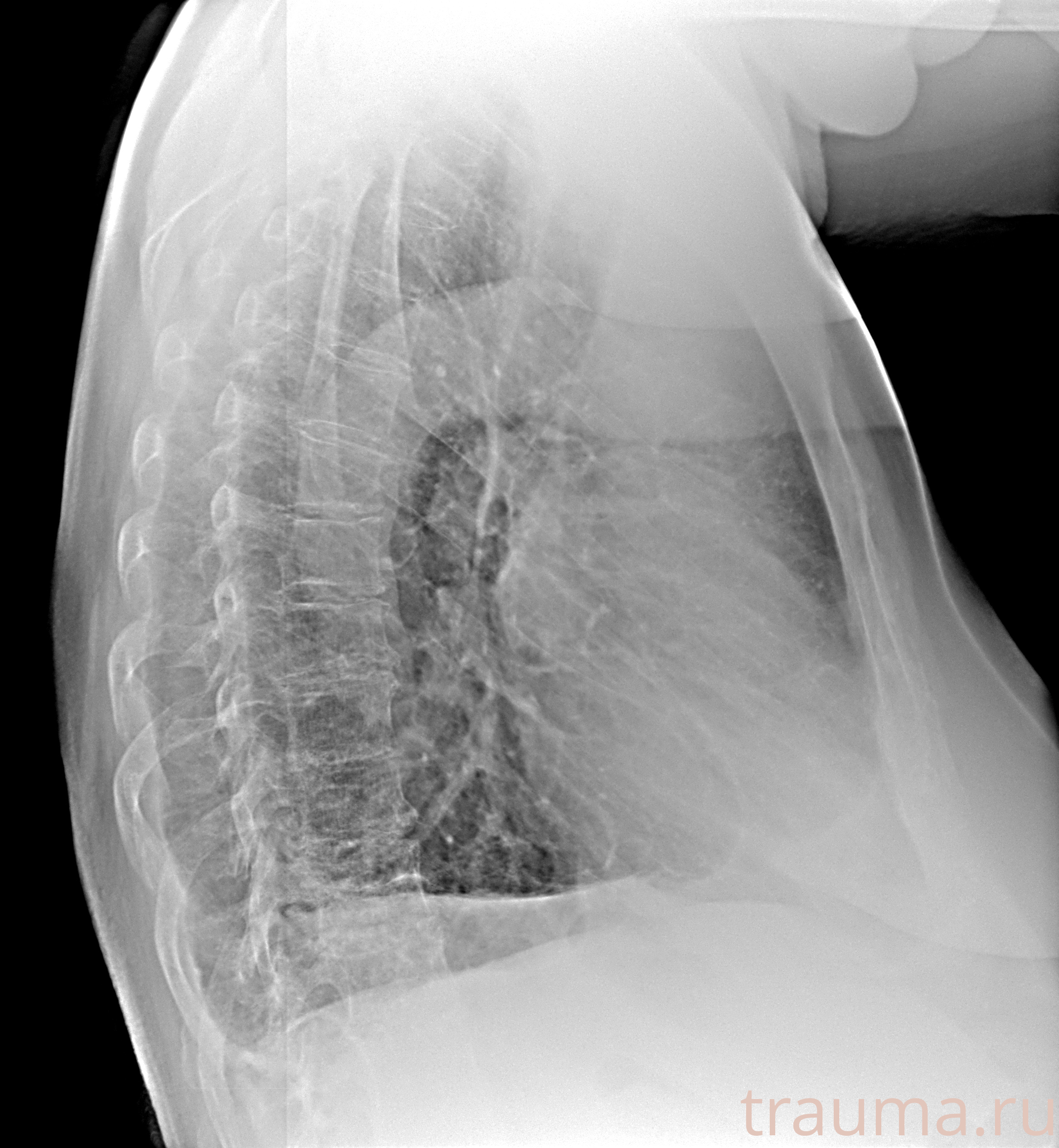 Рентген на дому: по вашему адресу приезжает врач-рентгенолог, травматолог-ортопед с мобильным рентгеновским аппаратом, проводит диагностику травмы или заболевания, делает необходимые рентгенограммы, дает рекомендации по дальнейшему лечению. Получить качественные снимки в домашних условиях возможно благодаря уникальной методике, разработанной МосРентген Центром для института  Склифосовского