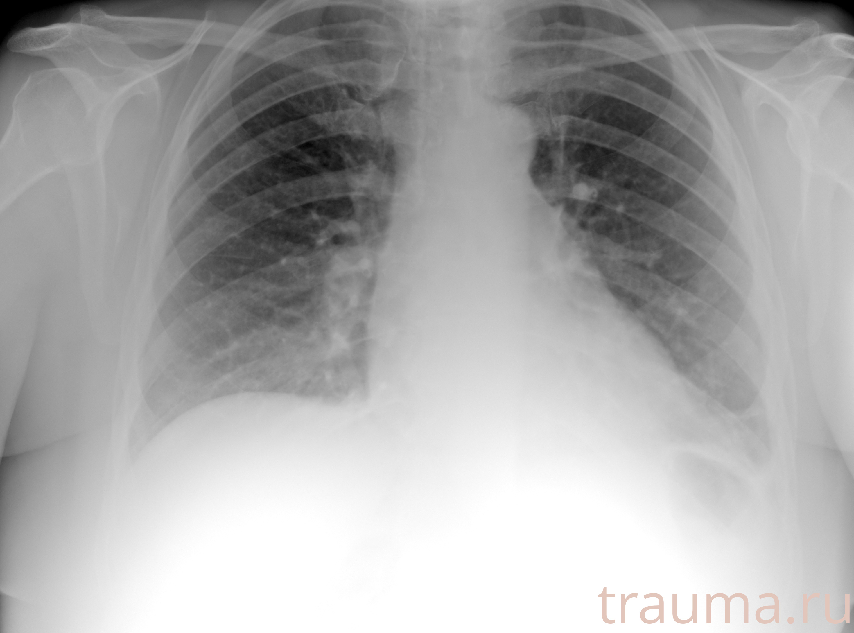 Рентген на дому: по вашему адресу приезжает врач-рентгенолог, травматолог-ортопед с мобильным рентгеновским аппаратом, проводит диагностику травмы или заболевания, делает необходимые рентгенограммы, дает рекомендации по дальнейшему лечению. Получить качественные снимки в домашних условиях возможно благодаря уникальной методике, разработанной МосРентген Центром для института  Склифосовского