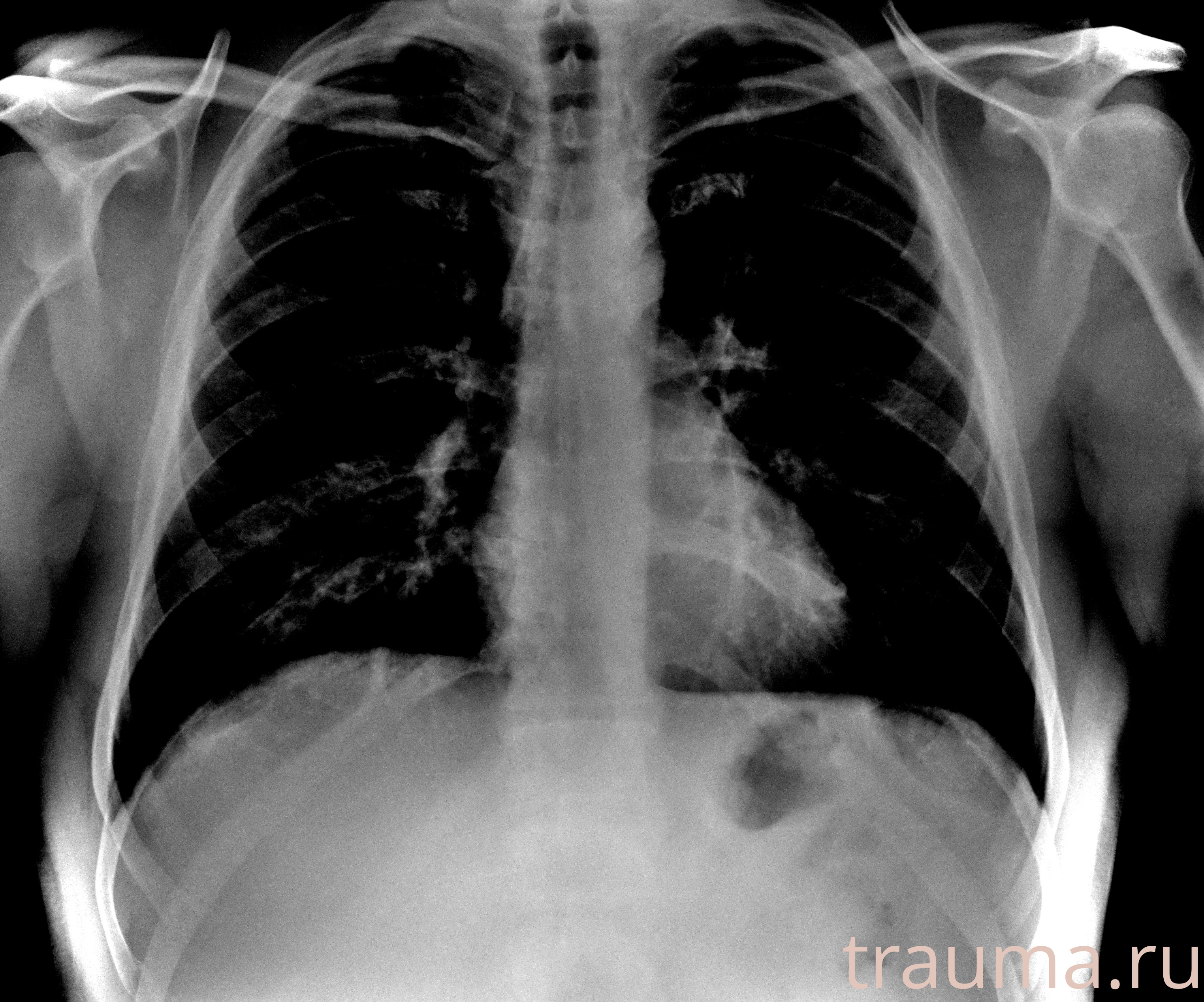 Рентген на дому: по вашему адресу приезжает врач-рентгенолог, травматолог-ортопед с мобильным рентгеновским аппаратом, проводит диагностику травмы или заболевания, делает необходимые рентгенограммы, дает рекомендации по дальнейшему лечению. Получить качественные снимки в домашних условиях возможно благодаря уникальной методике, разработанной МосРентген Центром для института  Склифосовского