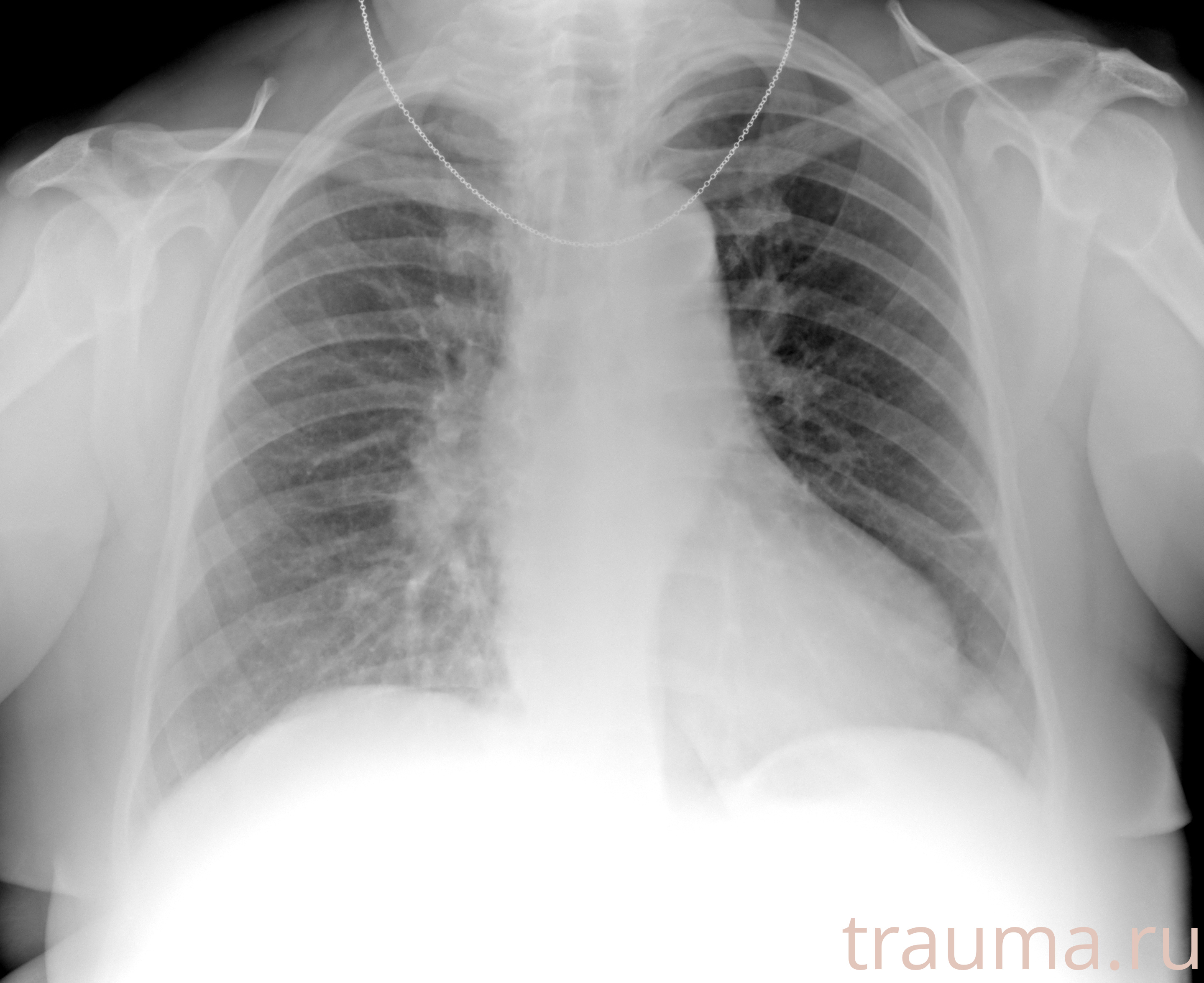 Рентген на дому: по вашему адресу приезжает врач-рентгенолог, травматолог-ортопед с мобильным рентгеновским аппаратом, проводит диагностику травмы или заболевания, делает необходимые рентгенограммы, дает рекомендации по дальнейшему лечению. Получить качественные снимки в домашних условиях возможно благодаря уникальной методике, разработанной МосРентген Центром для института  Склифосовского